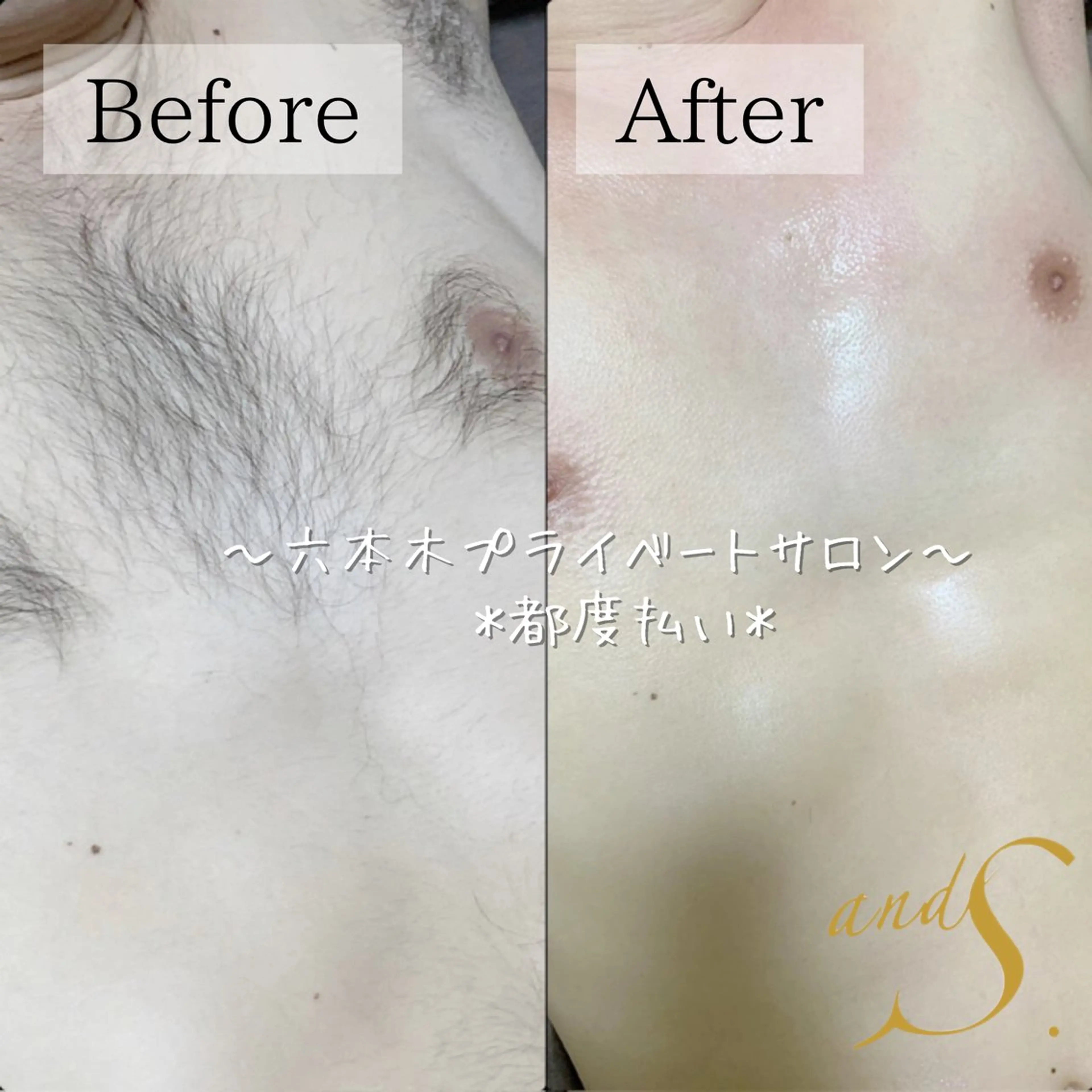 メンズ 🌸🧡六本木 脱毛しずか🧡🫧の眉毛・アイブロウイメージ