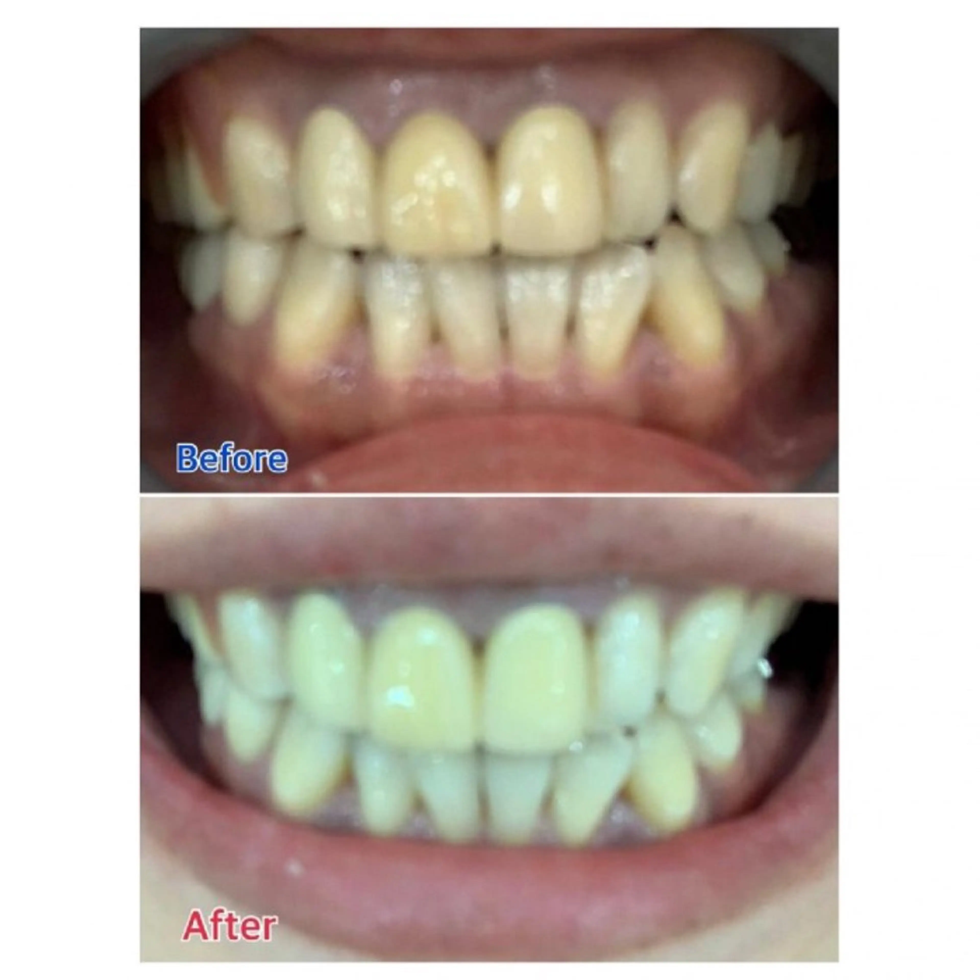 M渋谷店所属・Ｍ渋谷 ホワイトニングのその他イメージ