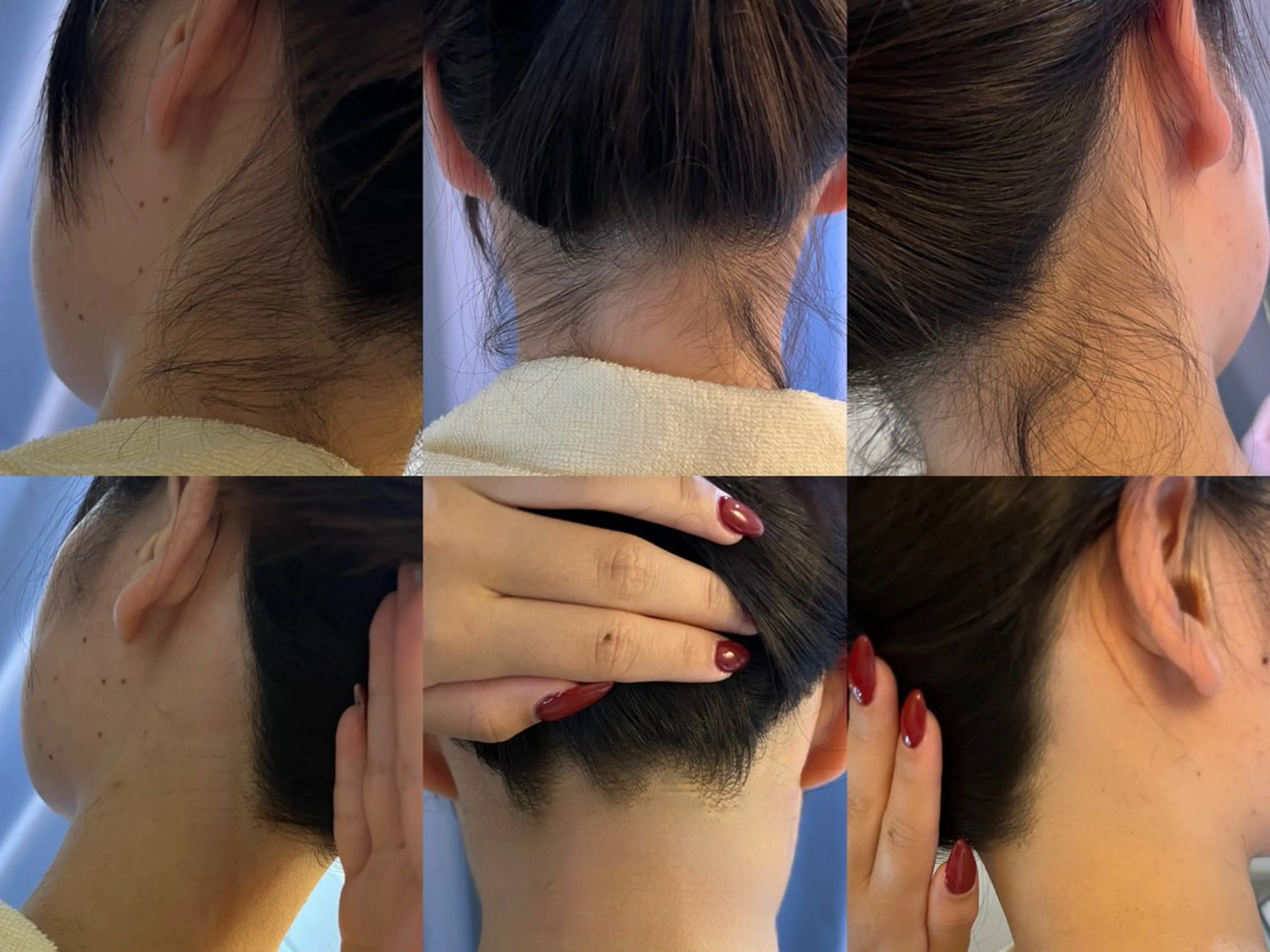 脱毛 うなじ脱毛/美肌脱毛 LABELのエステ・リラクイメージ