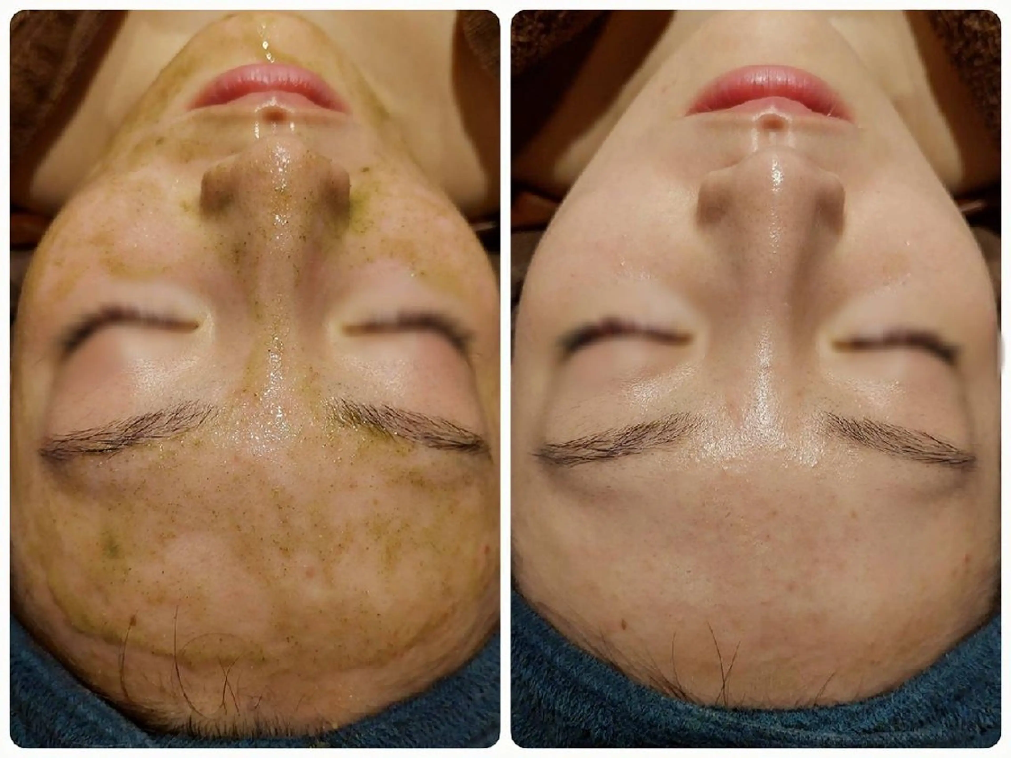 エステ MyFairLady miuのエステ・リラクイメージ