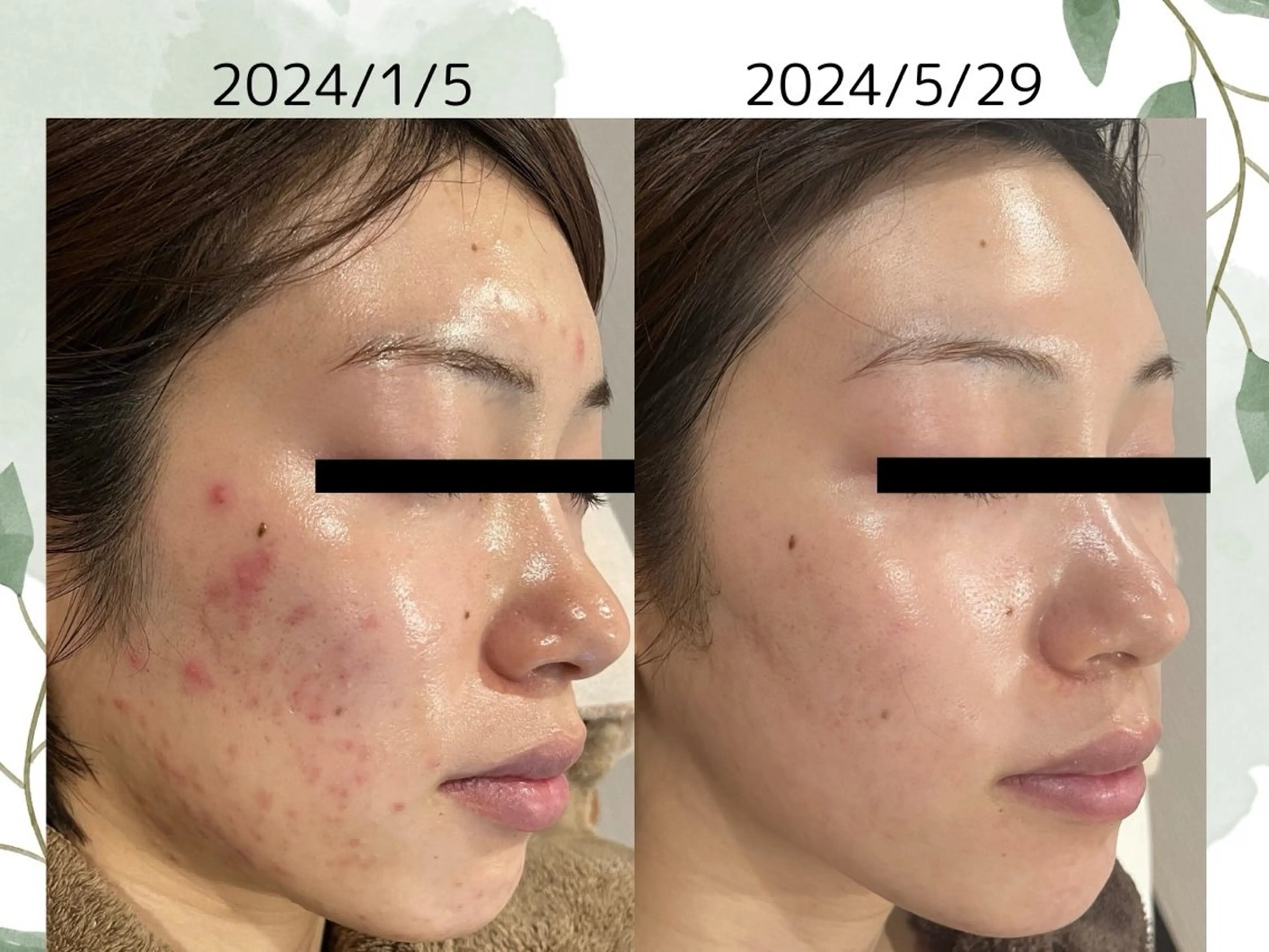 エステ リラク ベルーテ エッセンスのエステ・リラクイメージ