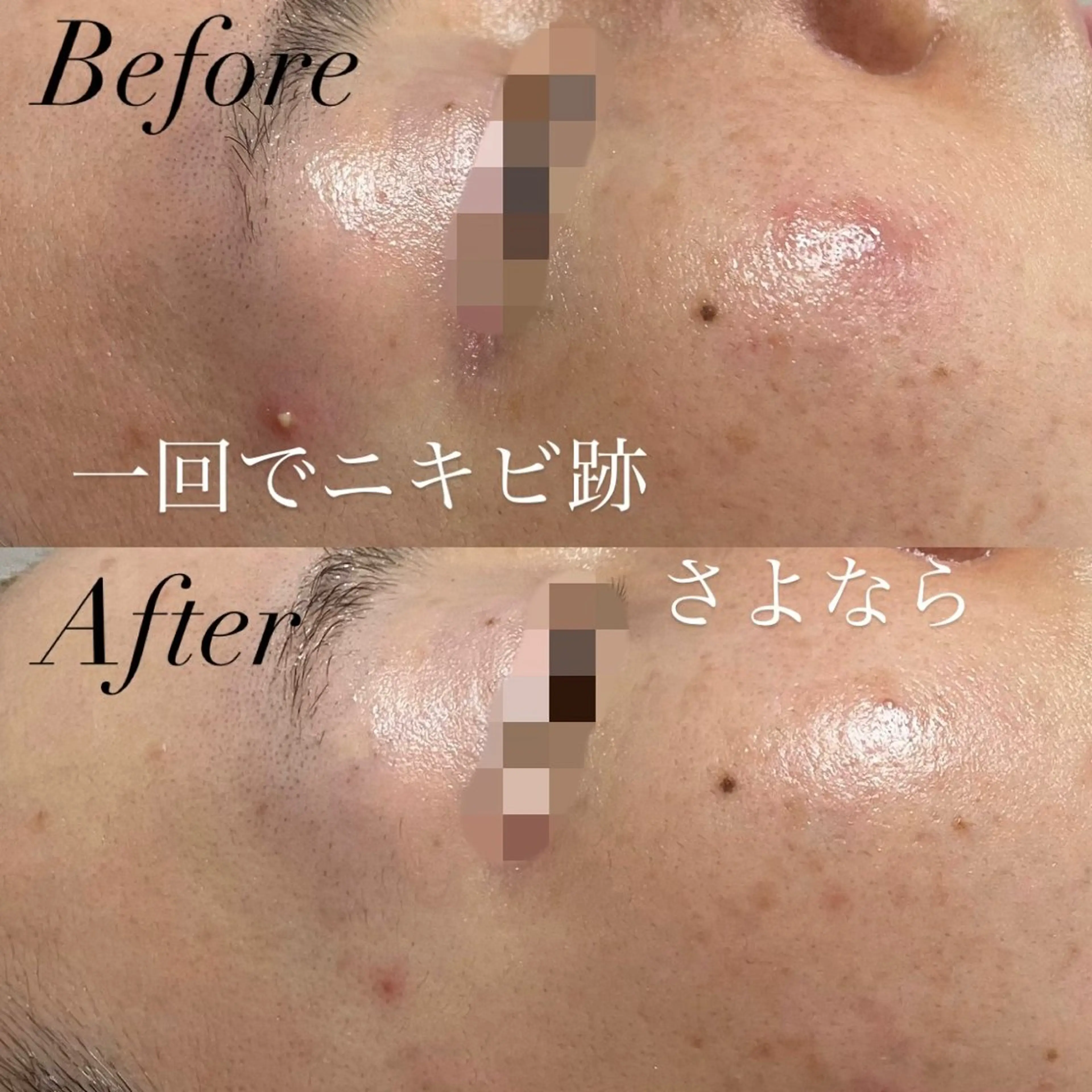 エステ プライベートサロン Belle（ベル）のエステ・リラクイメージ