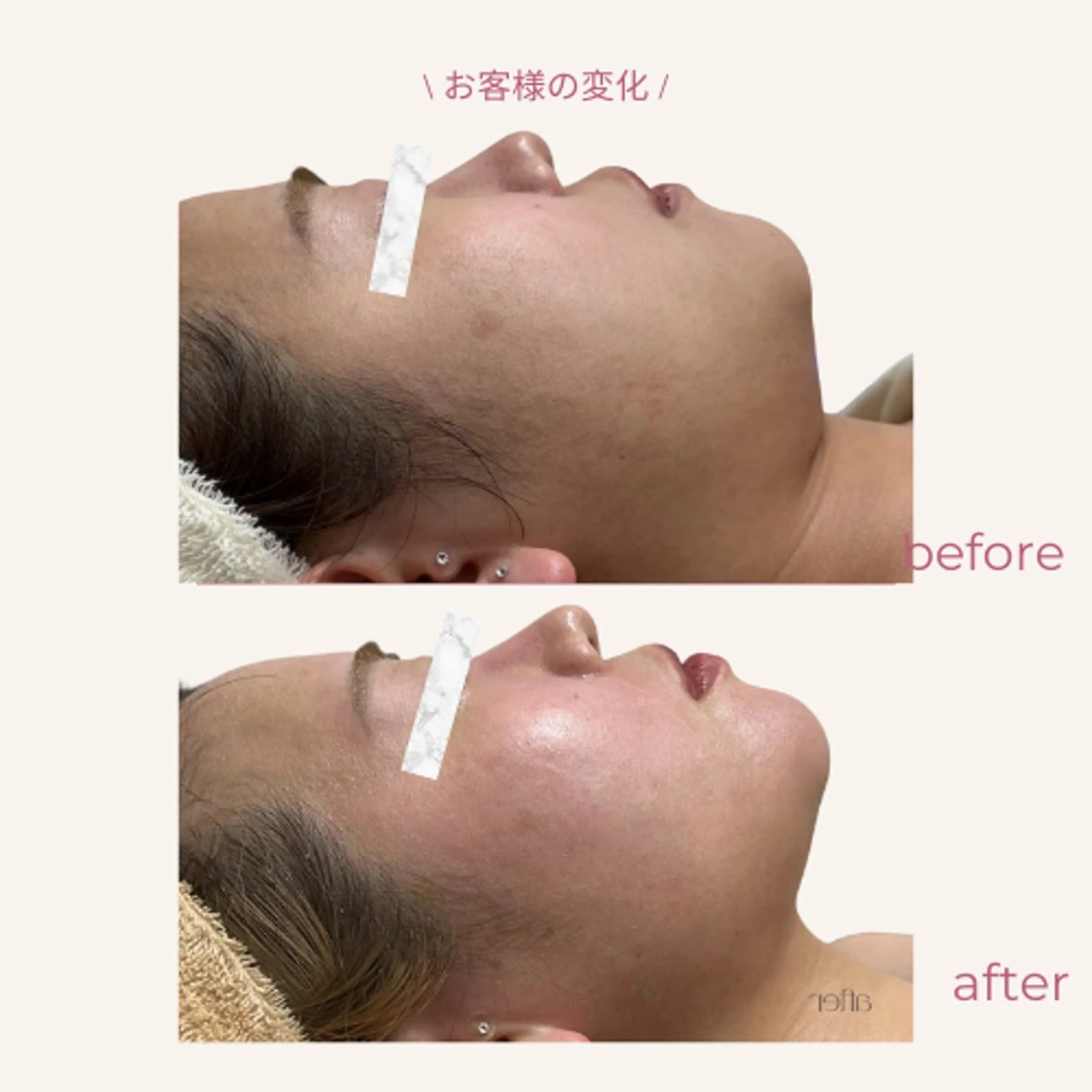 その他 aimer 服部のその他イメージ