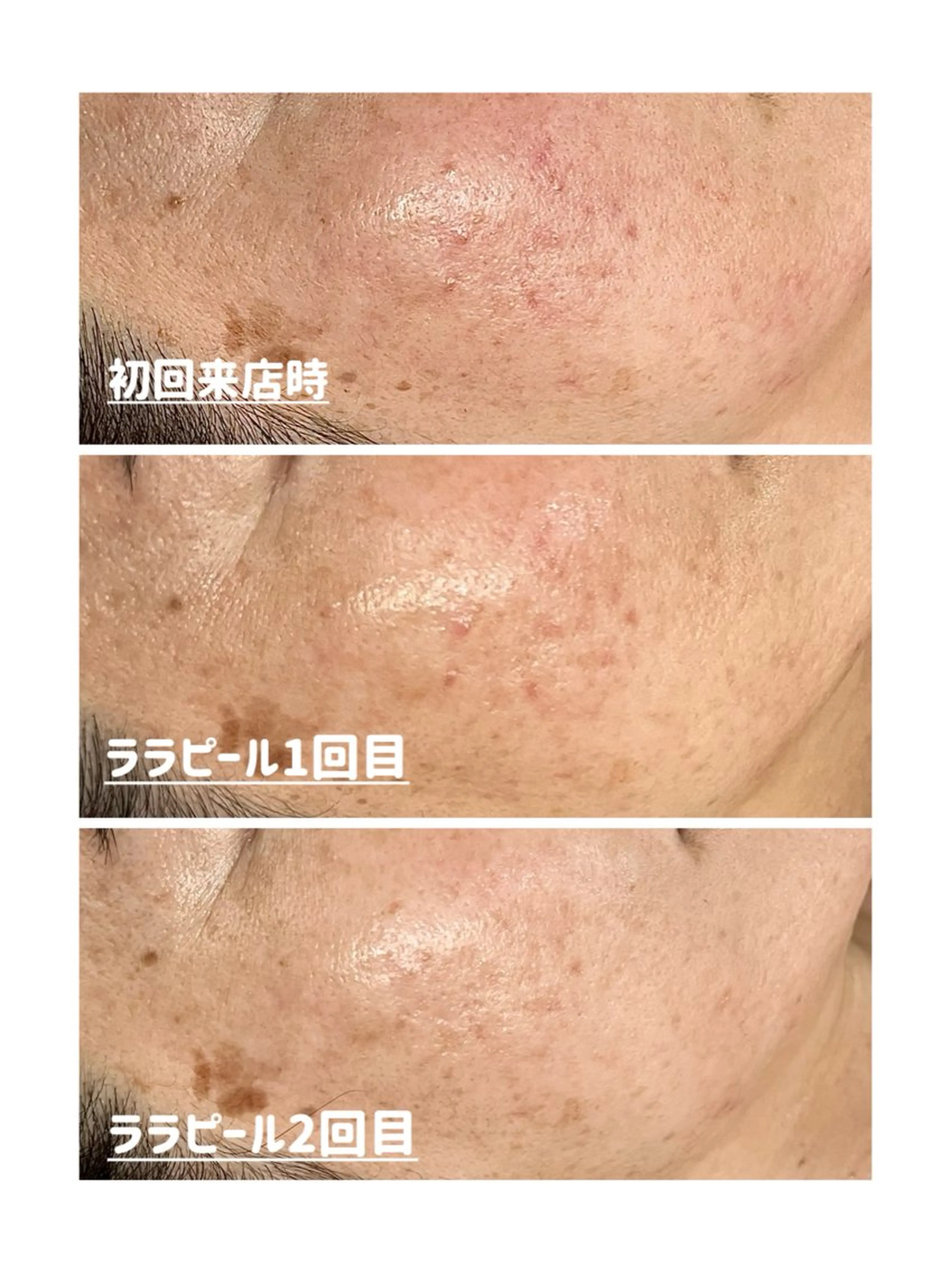 Leisurely レイジュアリーのエステ・リラクイメージ