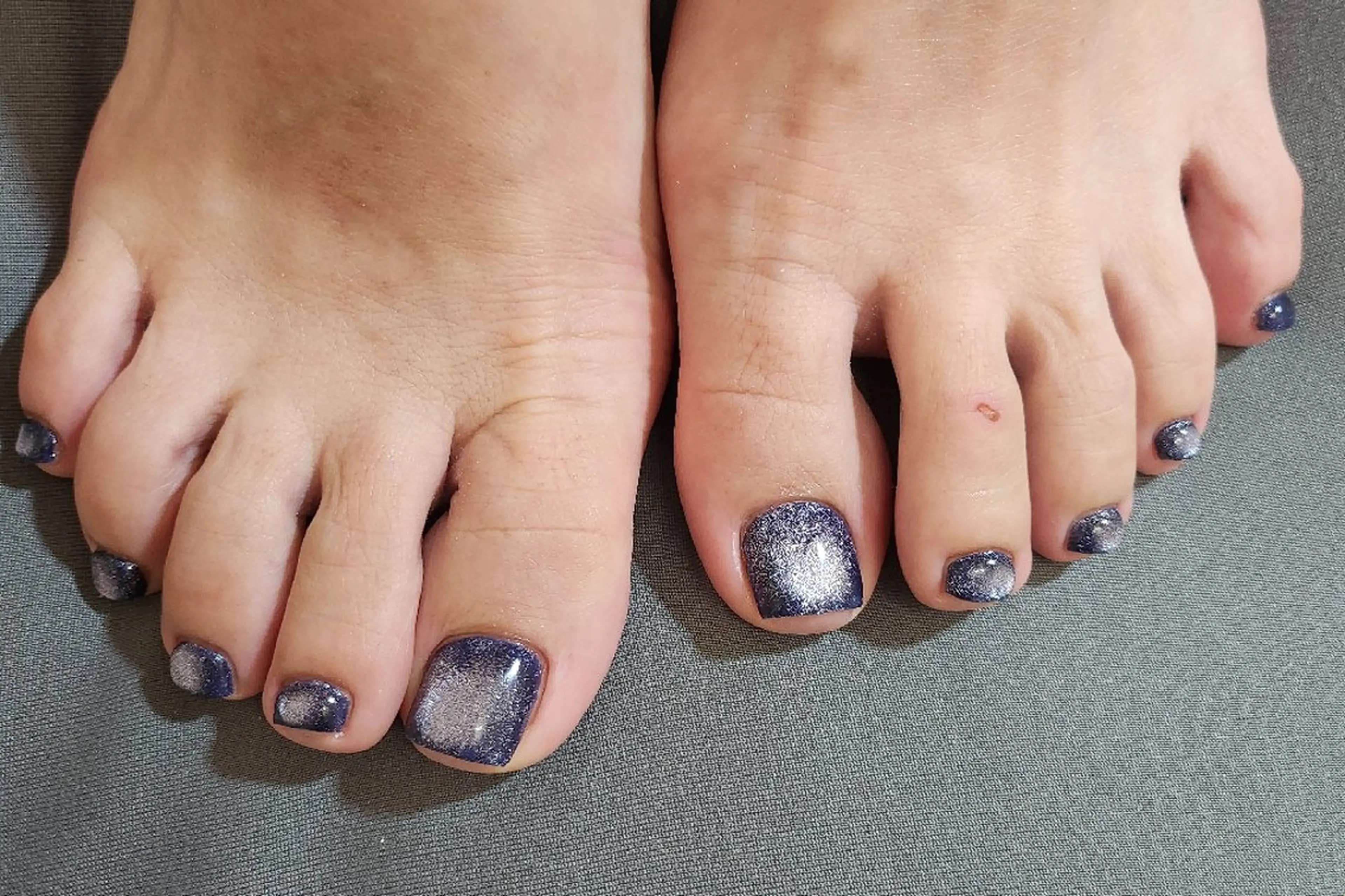 ネイル フットネイル MINON☆ Alet　salonのネイルデザイン