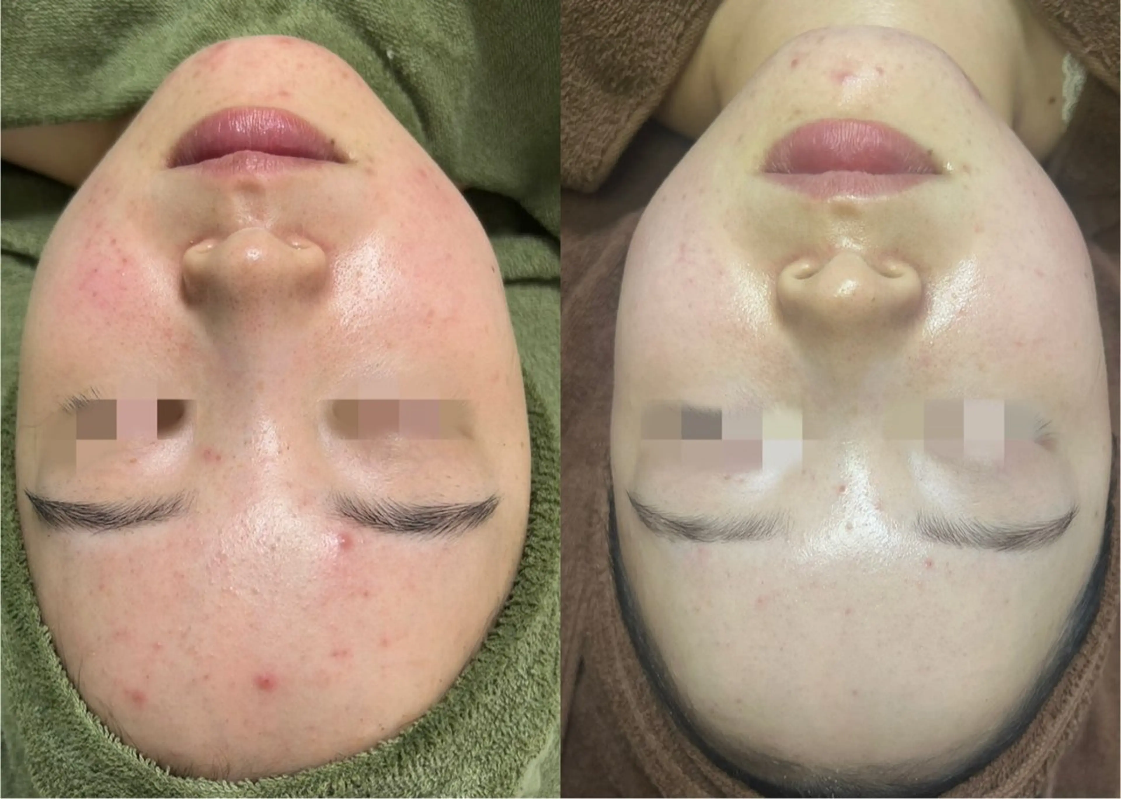 Beauty salon Lei所属・Salon Leiのエステ・リラクイメージ