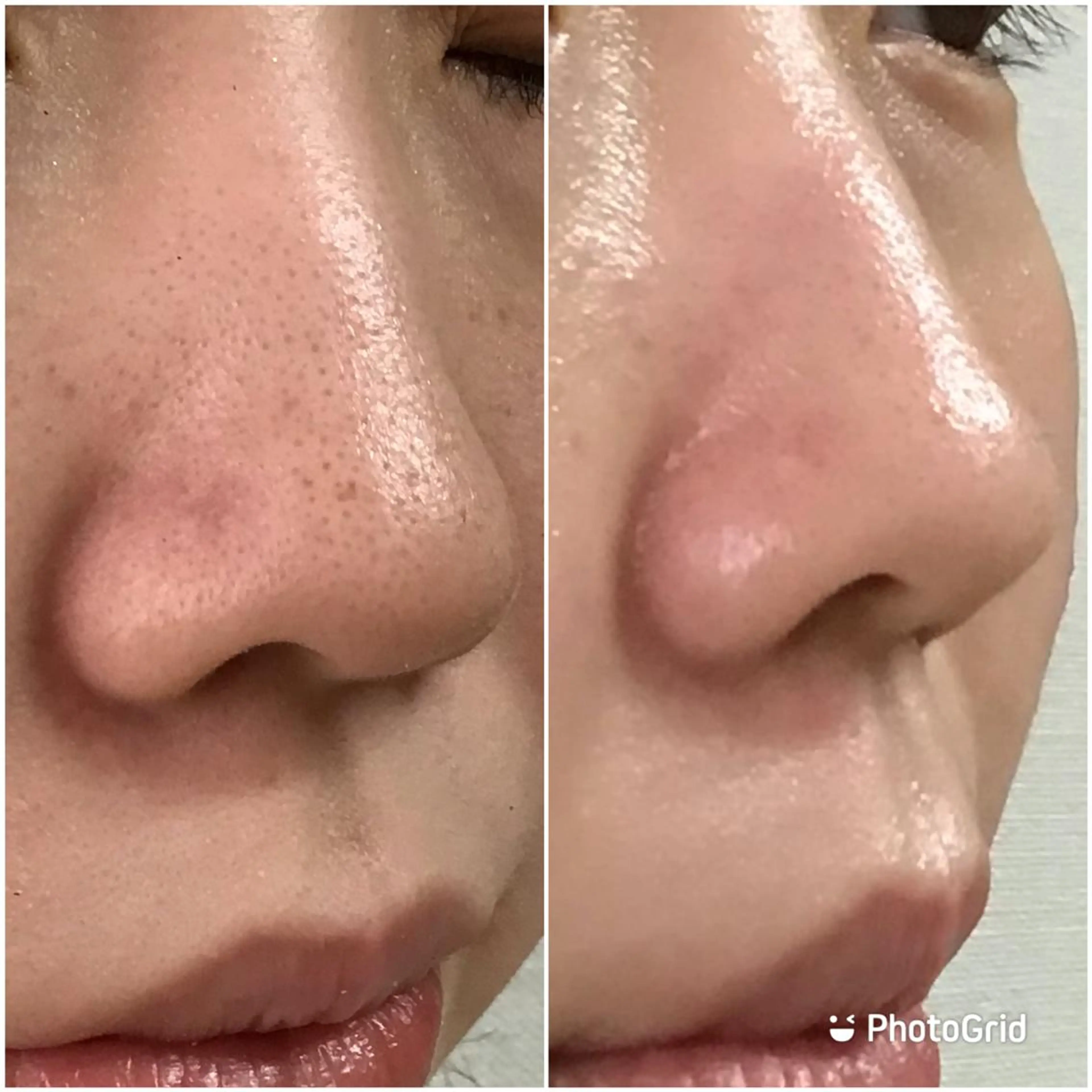 レイビス八戸店 野口のエステ・リラクイメージ