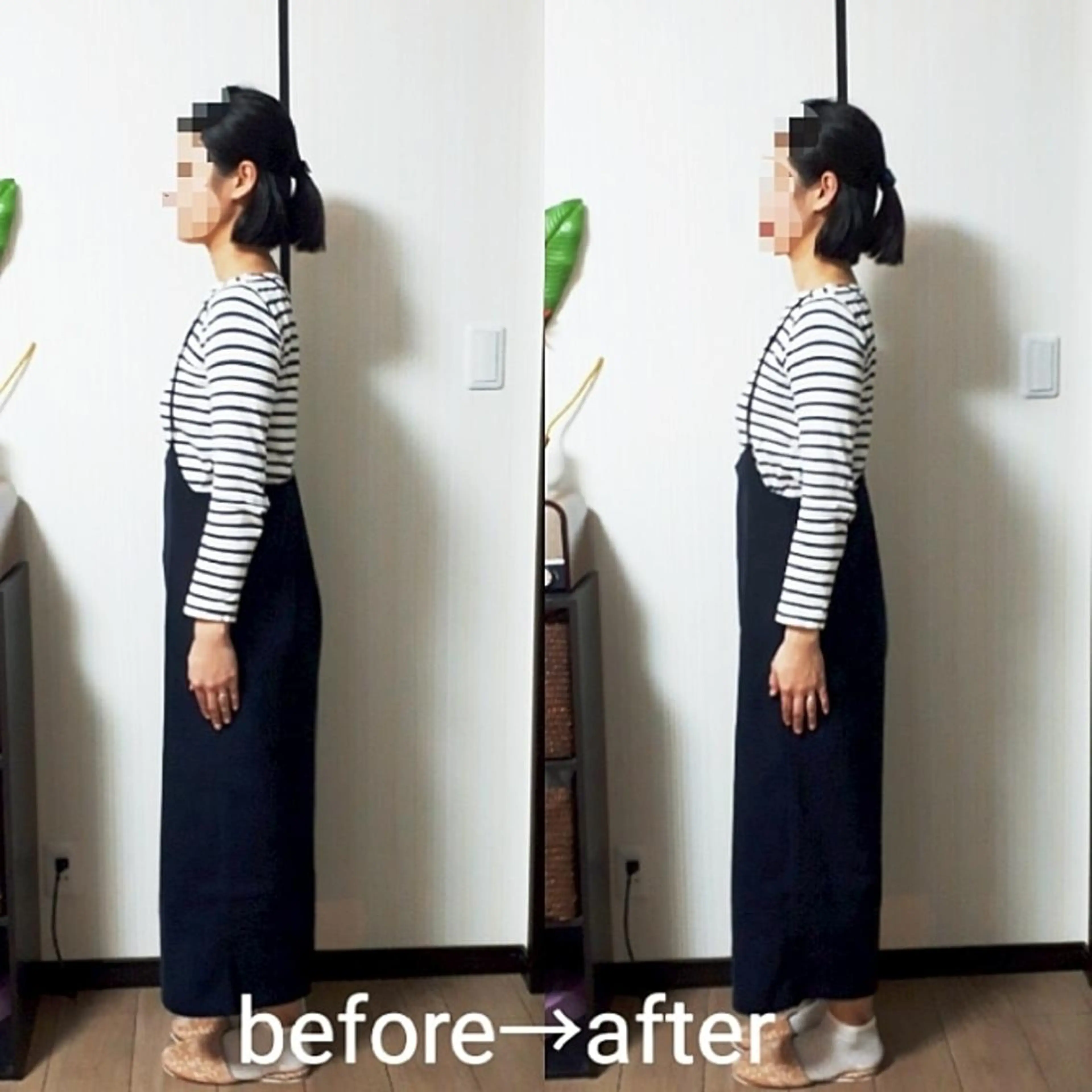 美容整体(ボディーのみ)の写真