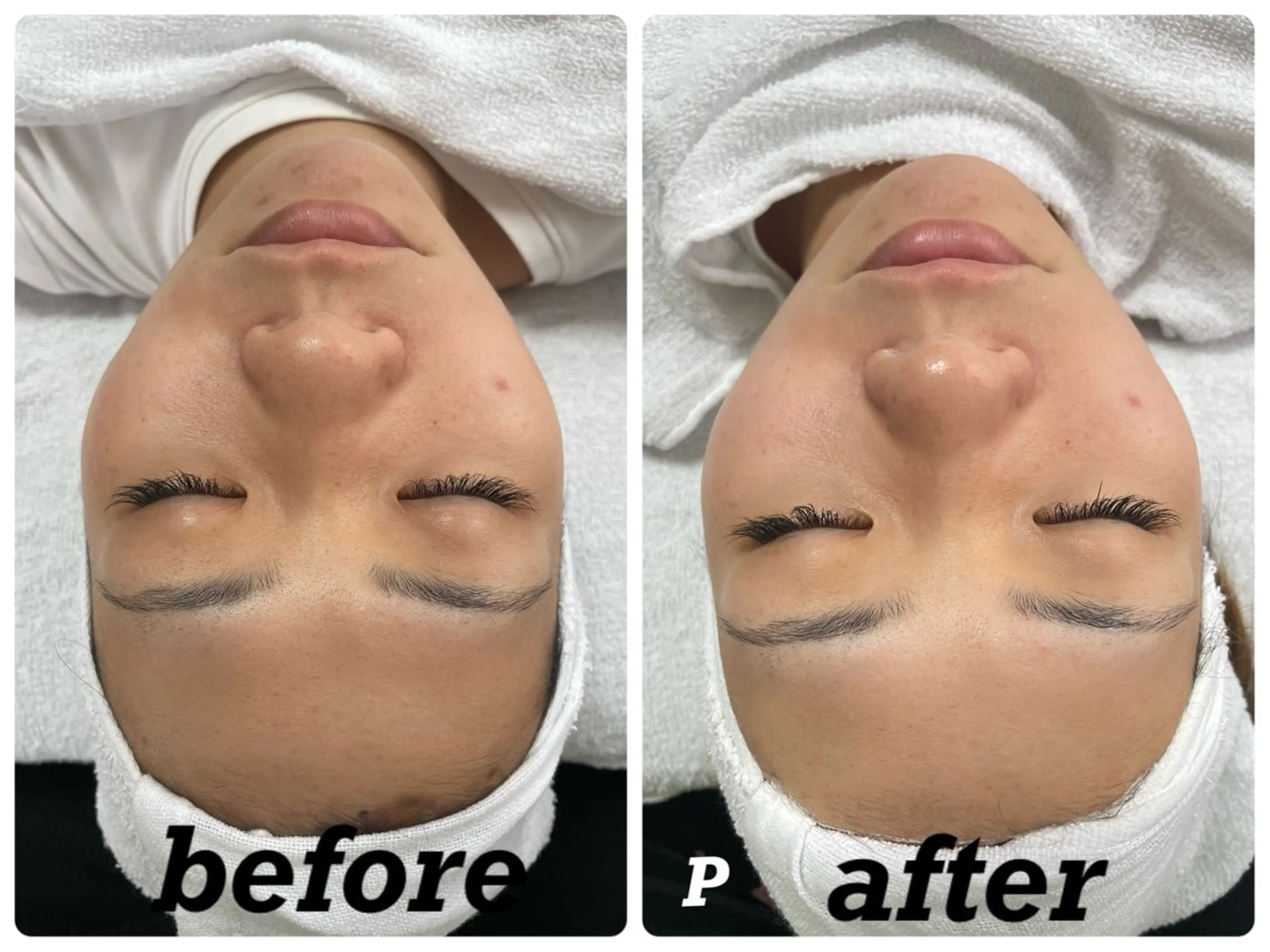 ÉMIA ✴︎のエステ・リラクイメージ