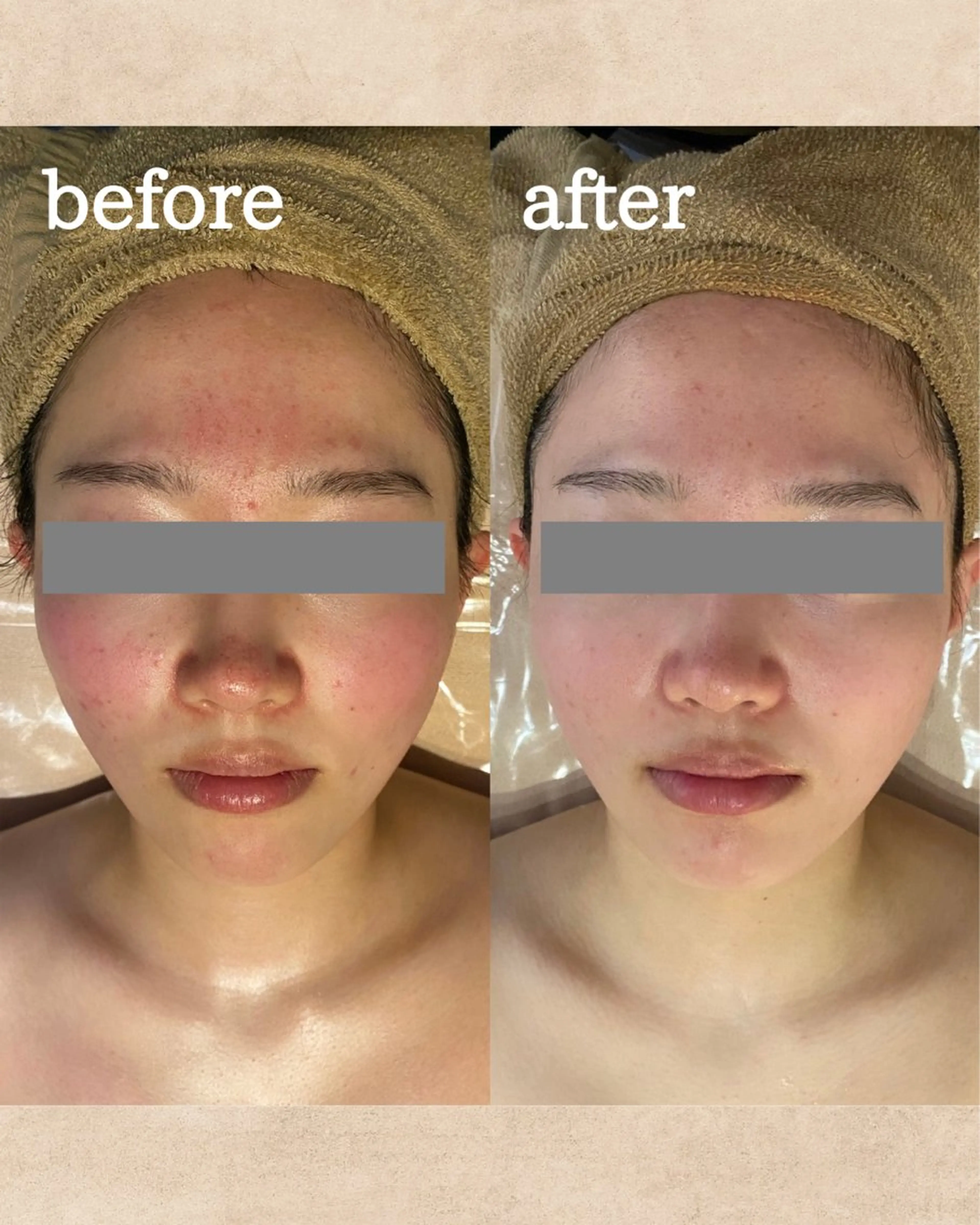 大人女性のための プライベートサロンのエステ・リラクイメージ