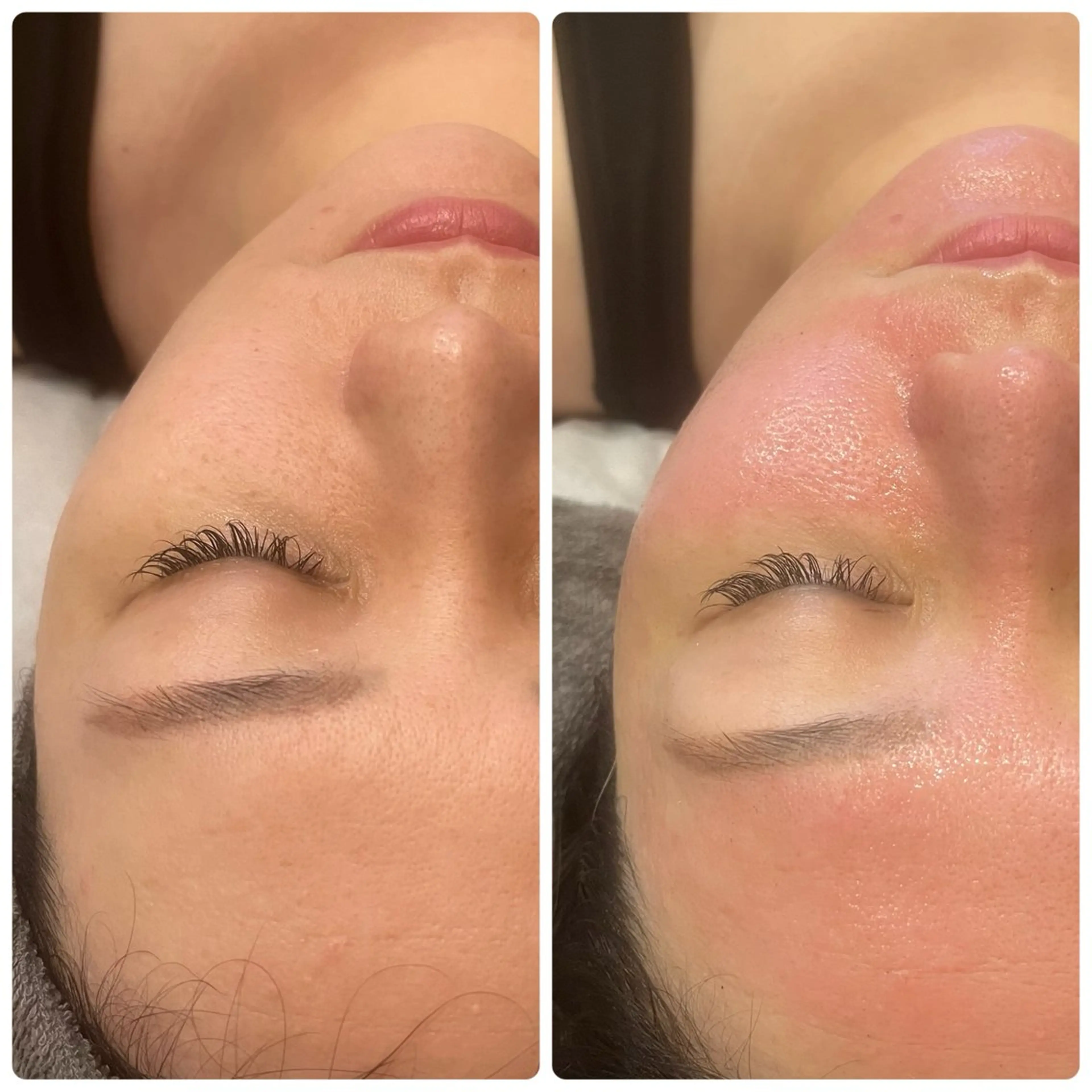 脱毛 yellow.所属・yellow💛【 脱毛&フェイシャル】のエステ・リラクイメージ