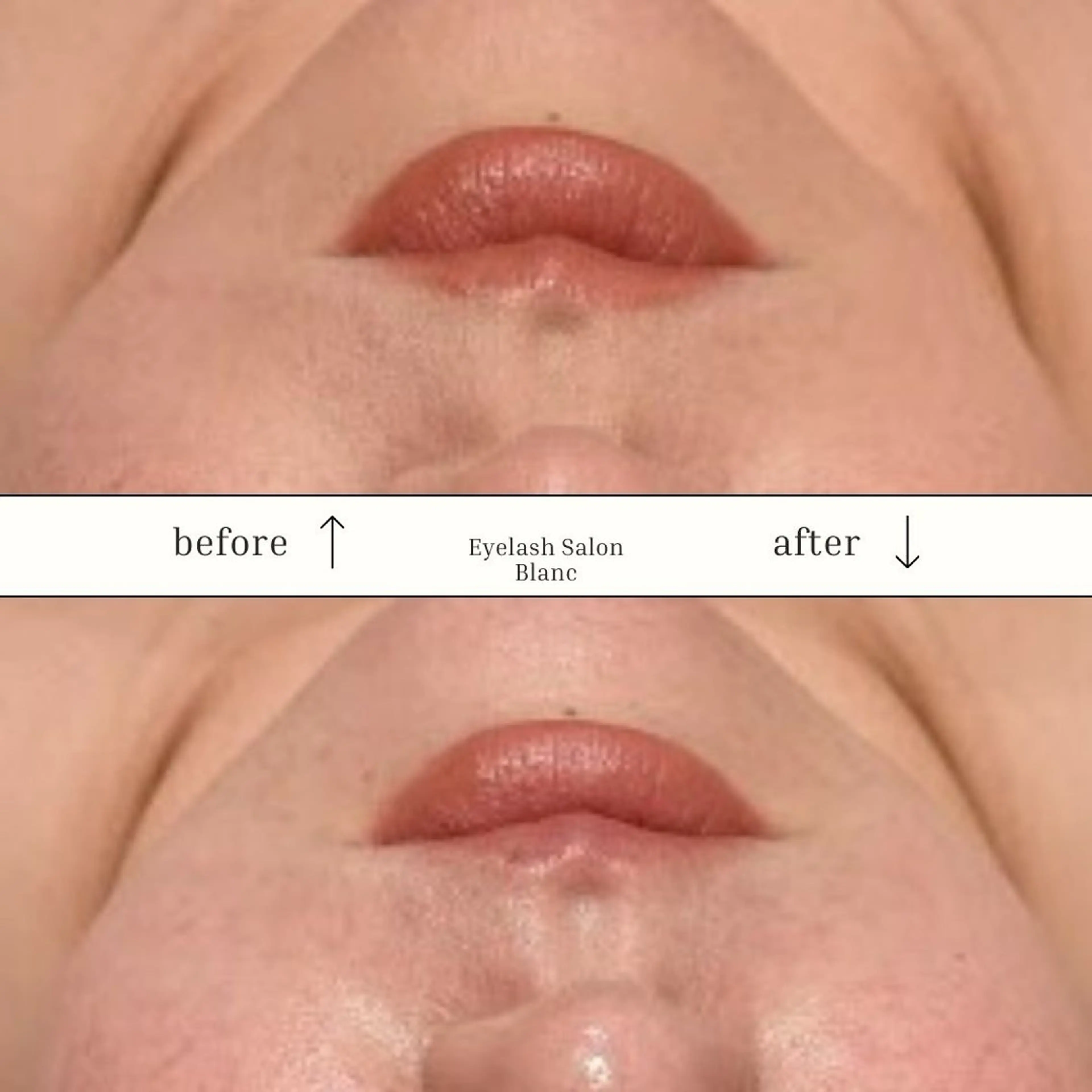 頭蓋骨小顔矯正 ハーブピーリングのエステ・リラクイメージ