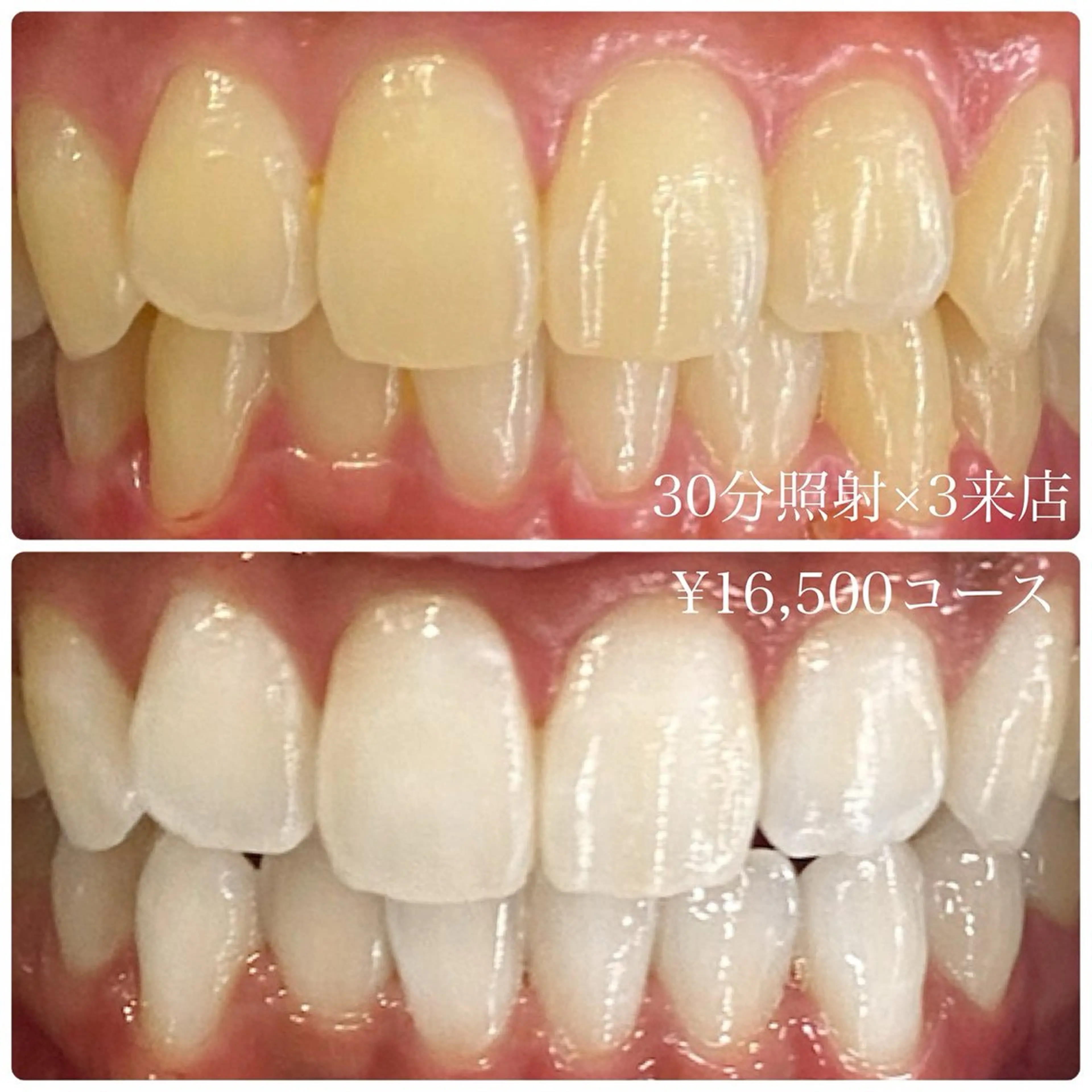 PLATINUM Beauty 横浜店所属・ホワイトニングルーム 横浜店のその他イメージ