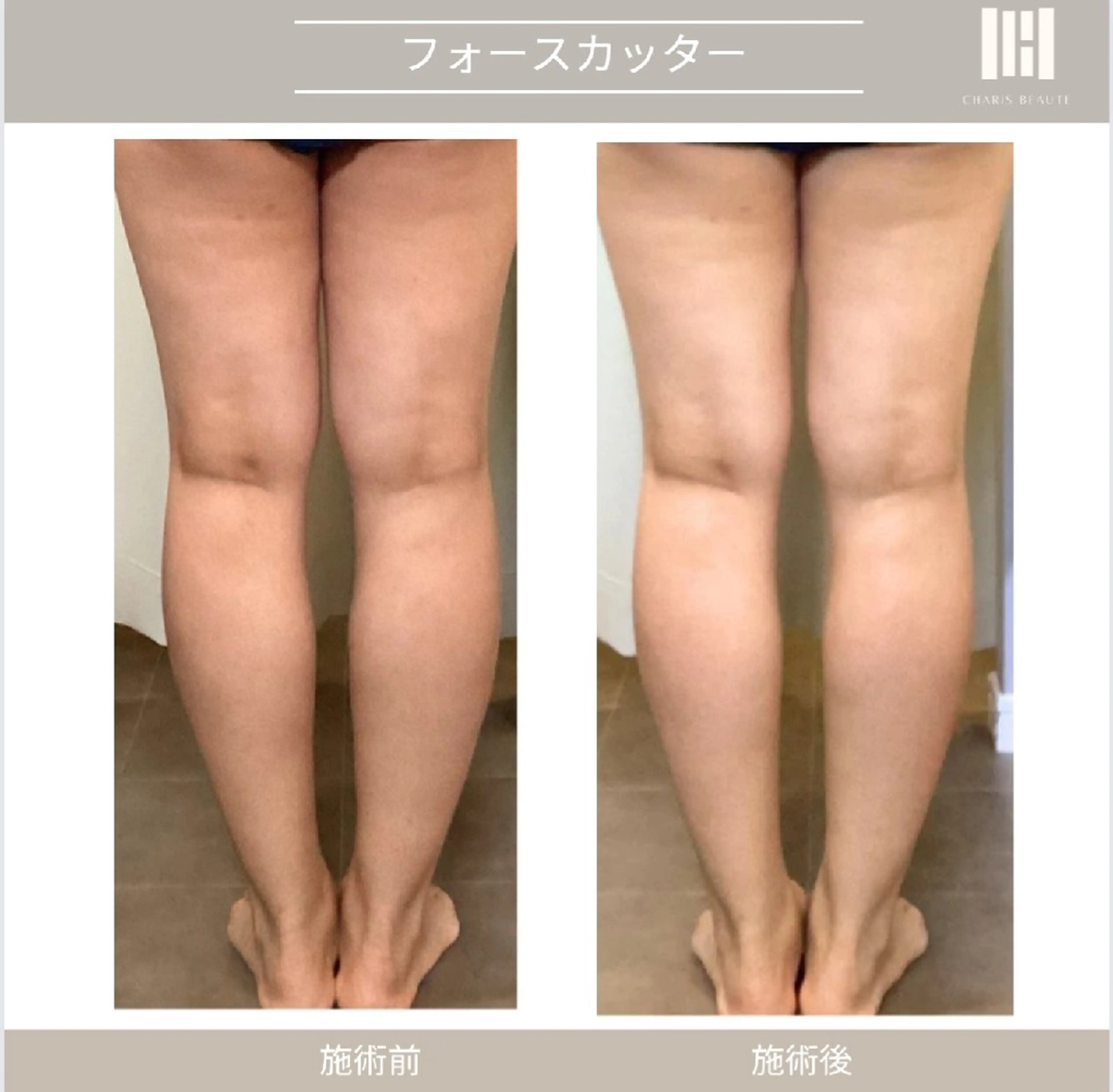 その他 上杉 彩のエステ・リラクイメージ