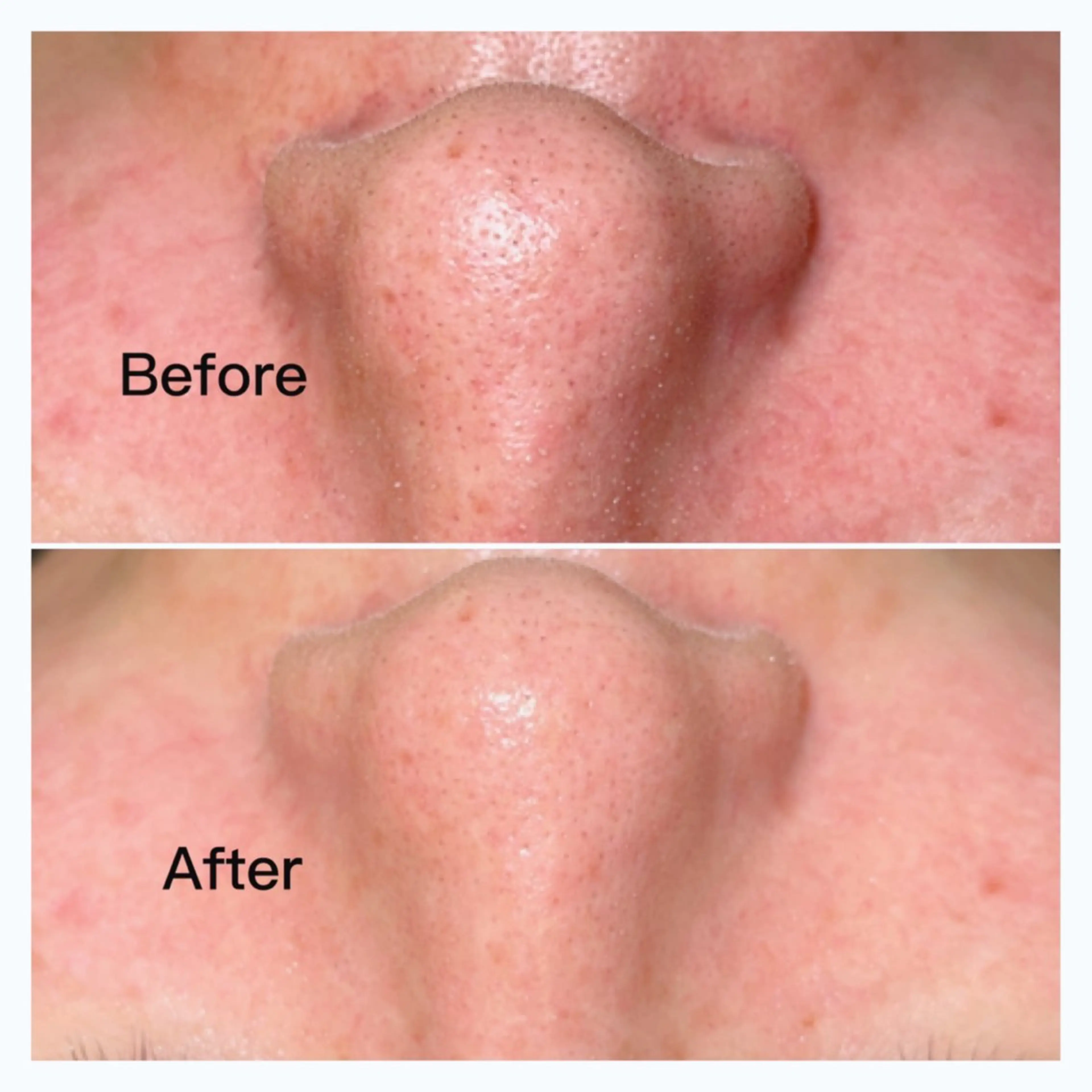 エステ SELF  BEAUTY gracia浦添店所属・gracia 浦添店のその他イメージ