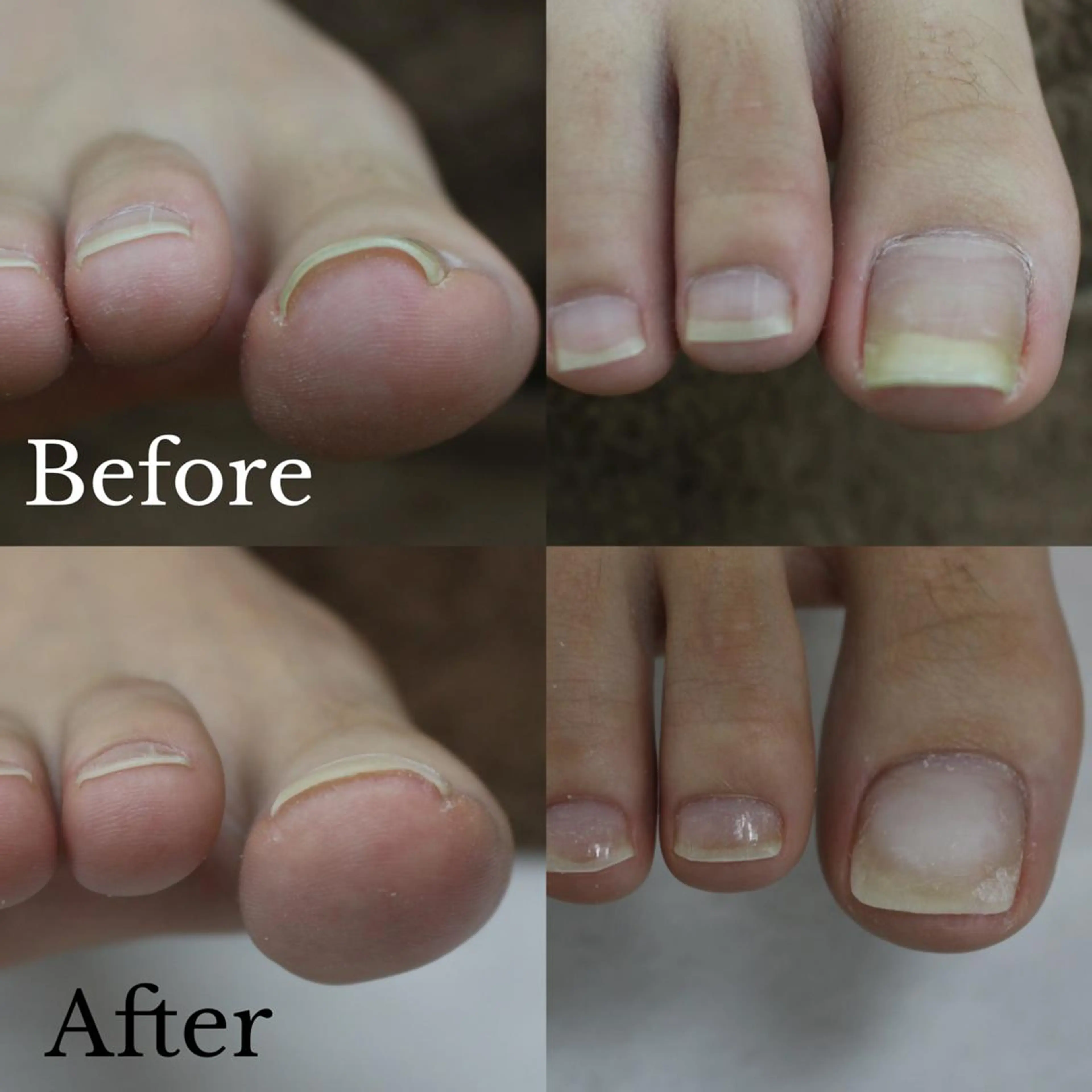 東 あきらのネイルデザイン