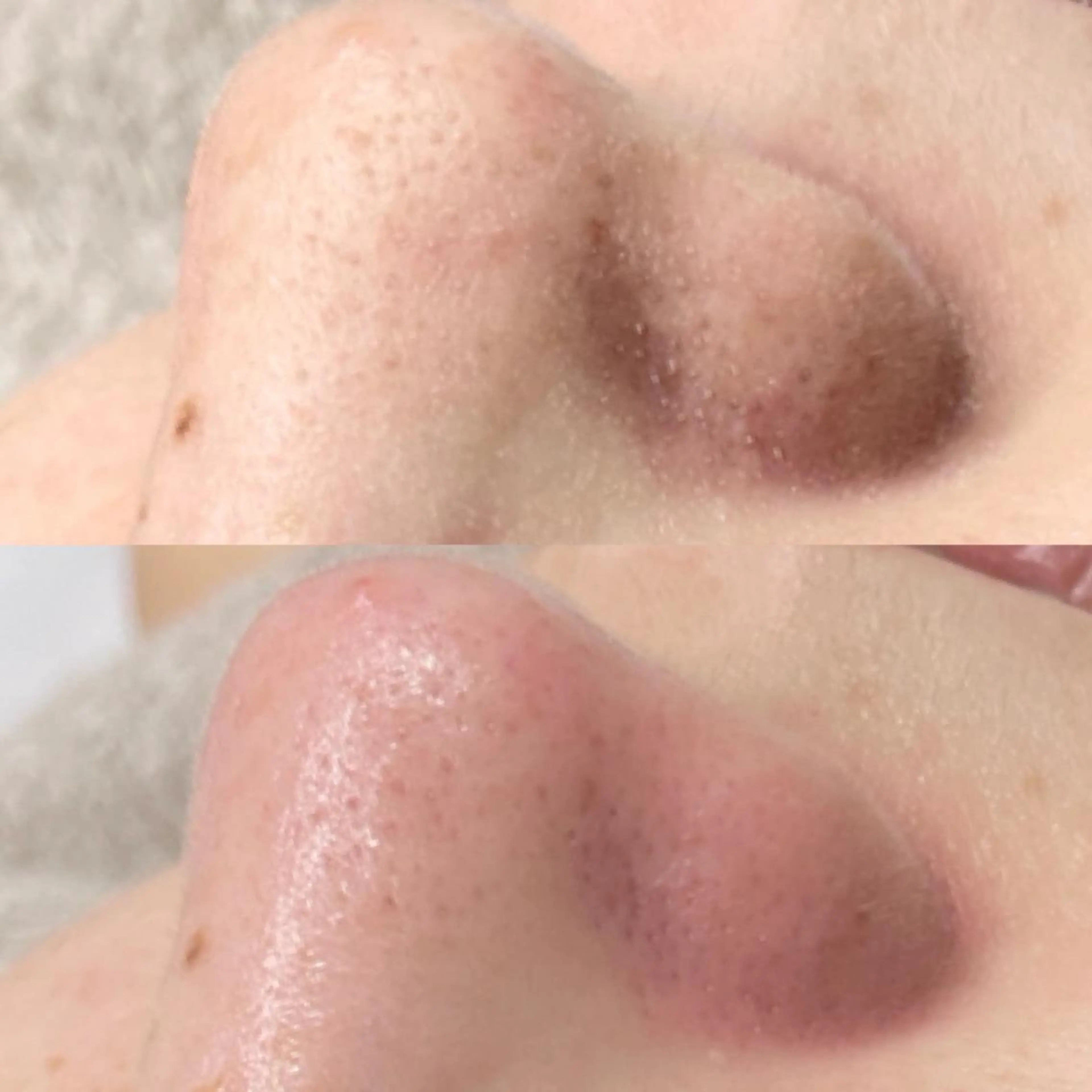 ピーリング専門サロン Spicaのエステ・リラクイメージ