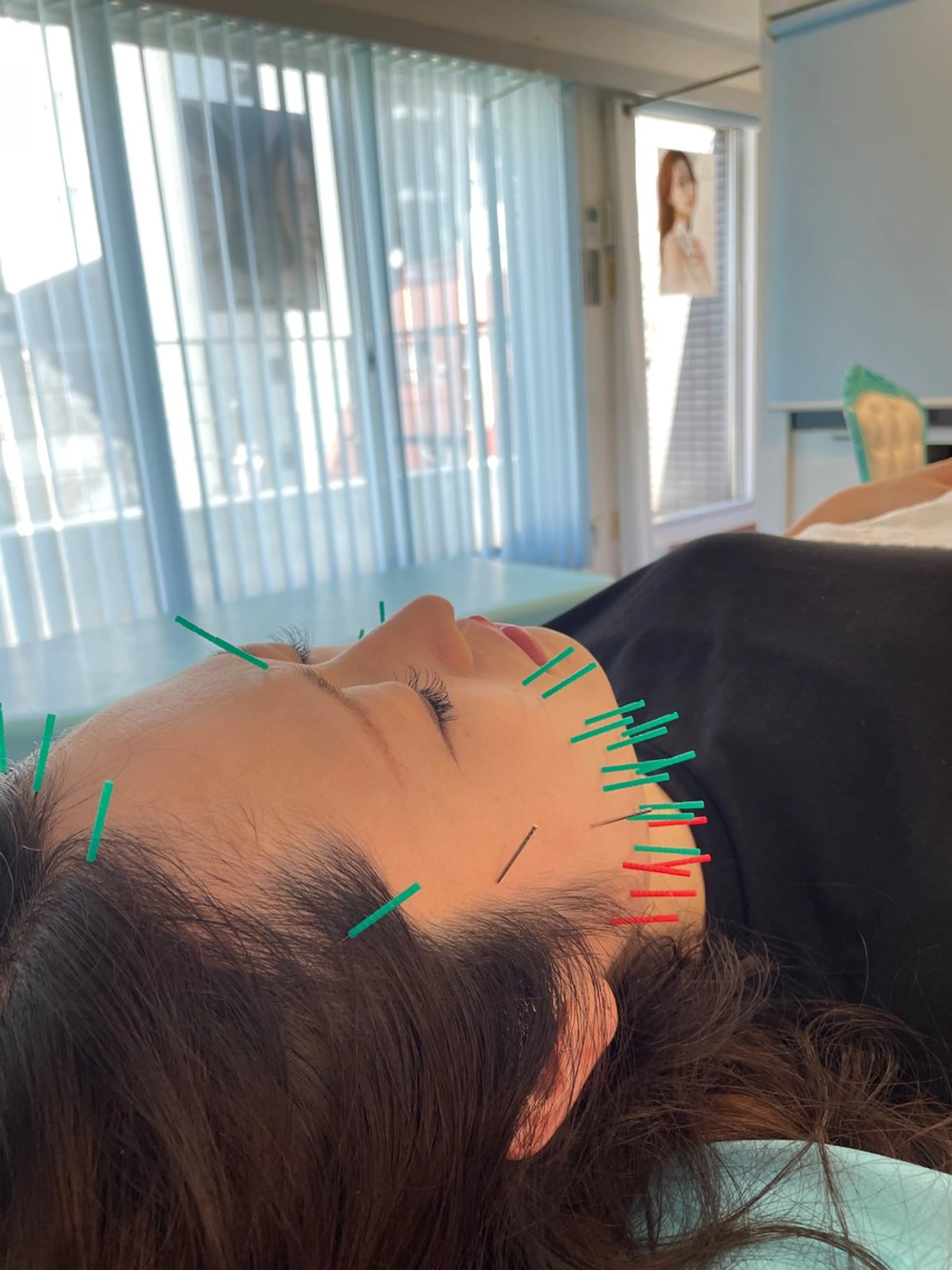 エステ リラク 小顔美容鍼専門サロン 渋谷YZのエステ・リラクイメージ