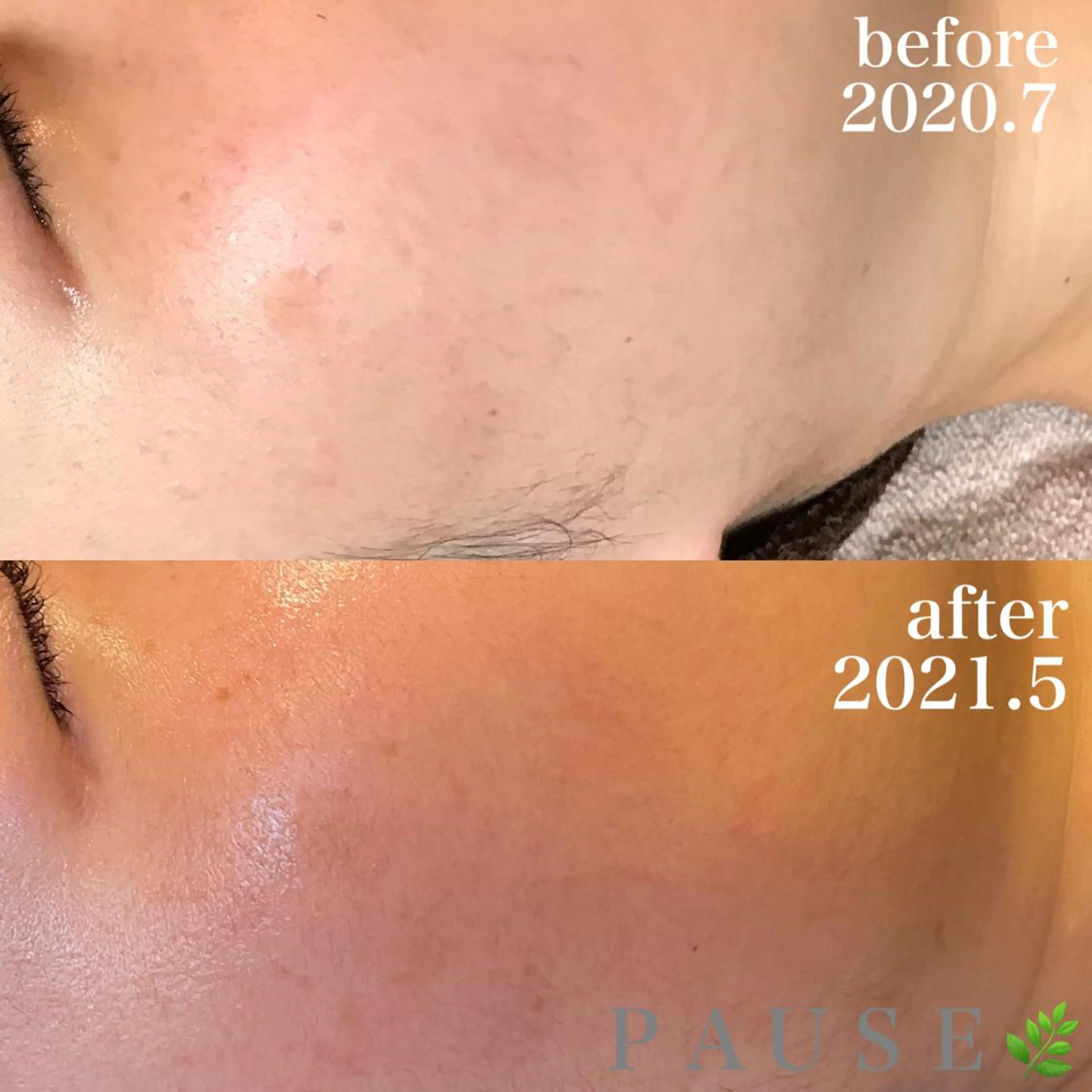 エステ 浜野 恵美のエステ・リラクイメージ