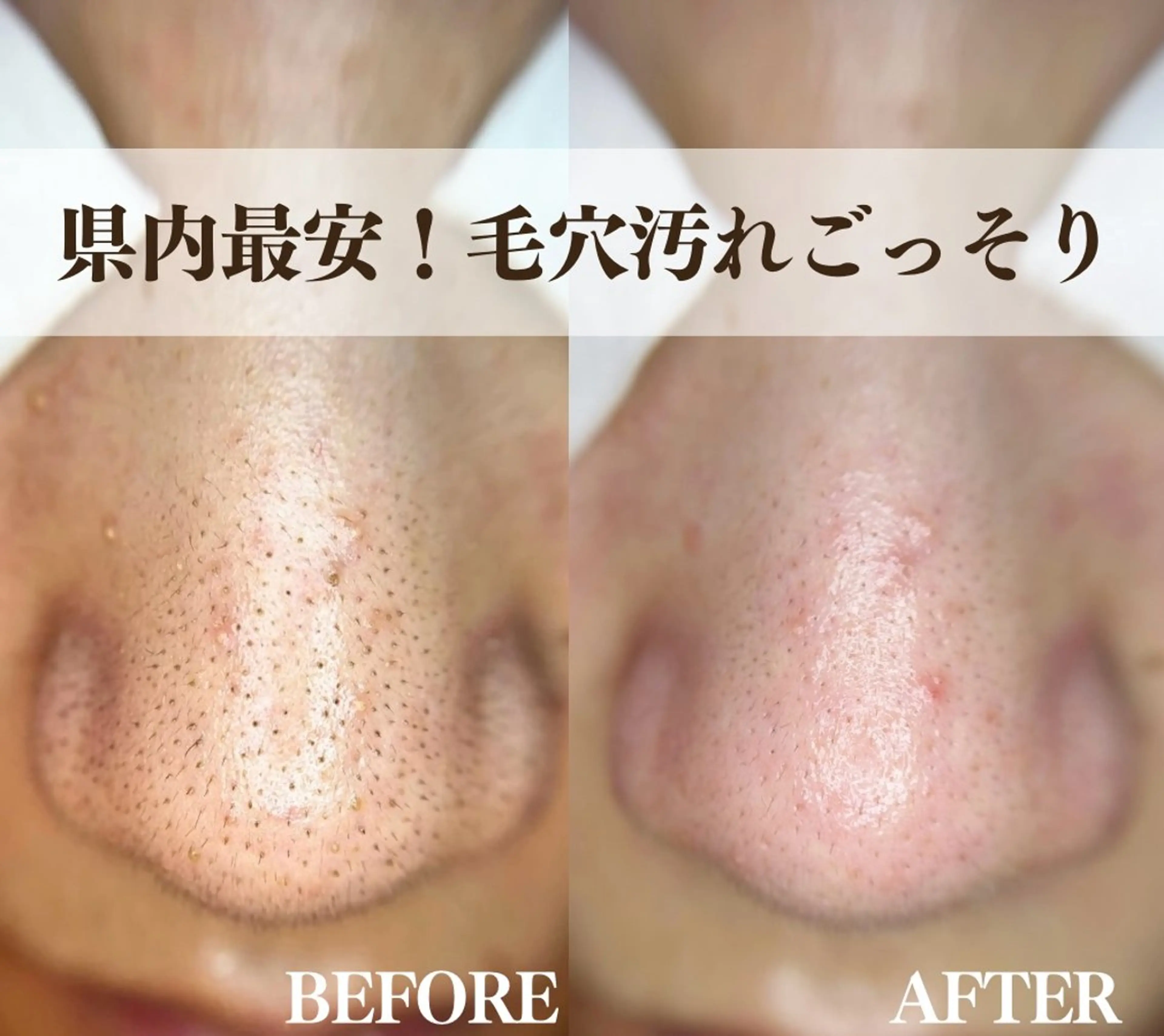 エステ salon MUSUBUのエステ・リラクイメージ