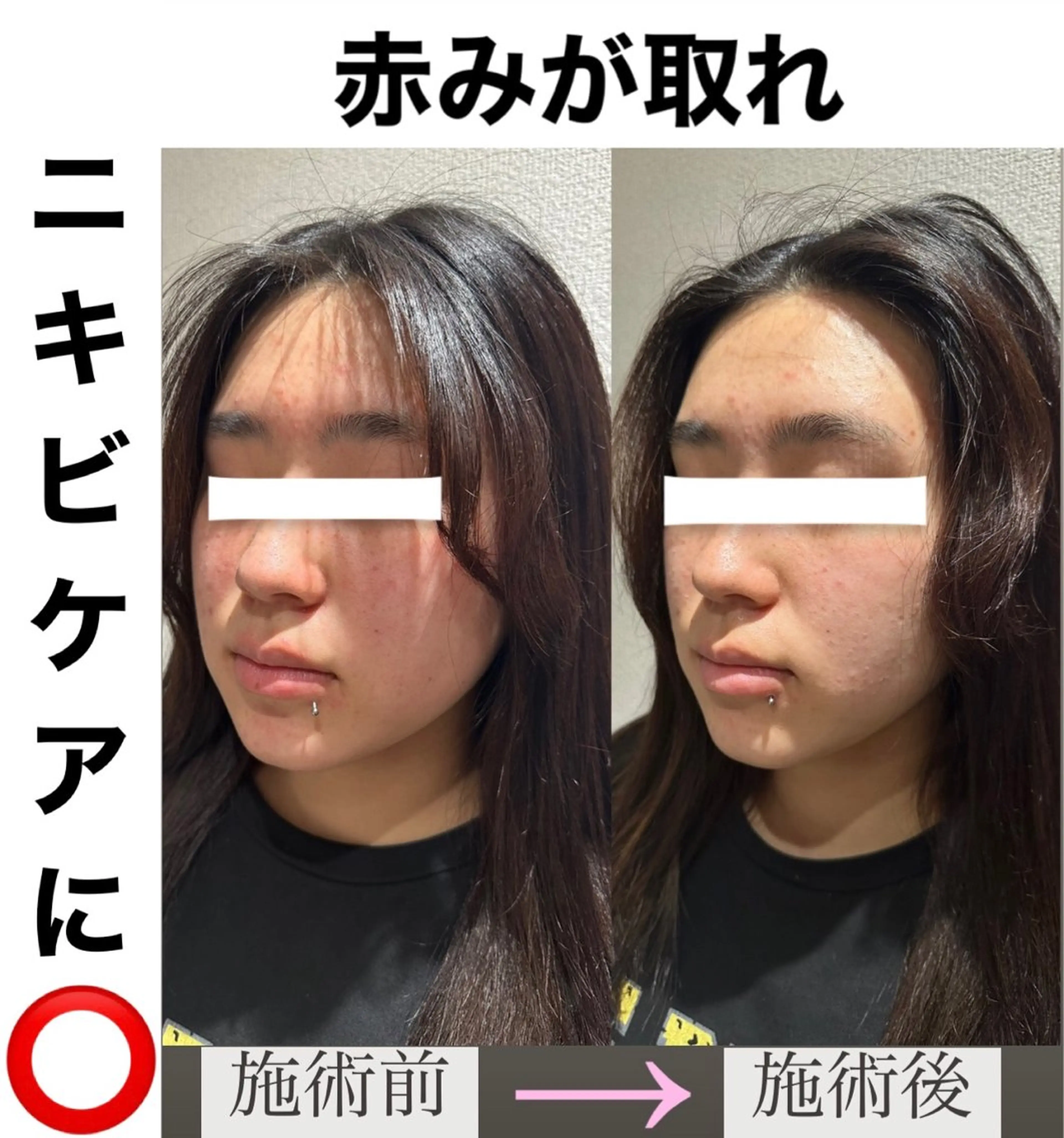 脱毛&美容サロンBLUESEA所属・脱毛&美容サロン BLUESEAのエステ・リラクイメージ