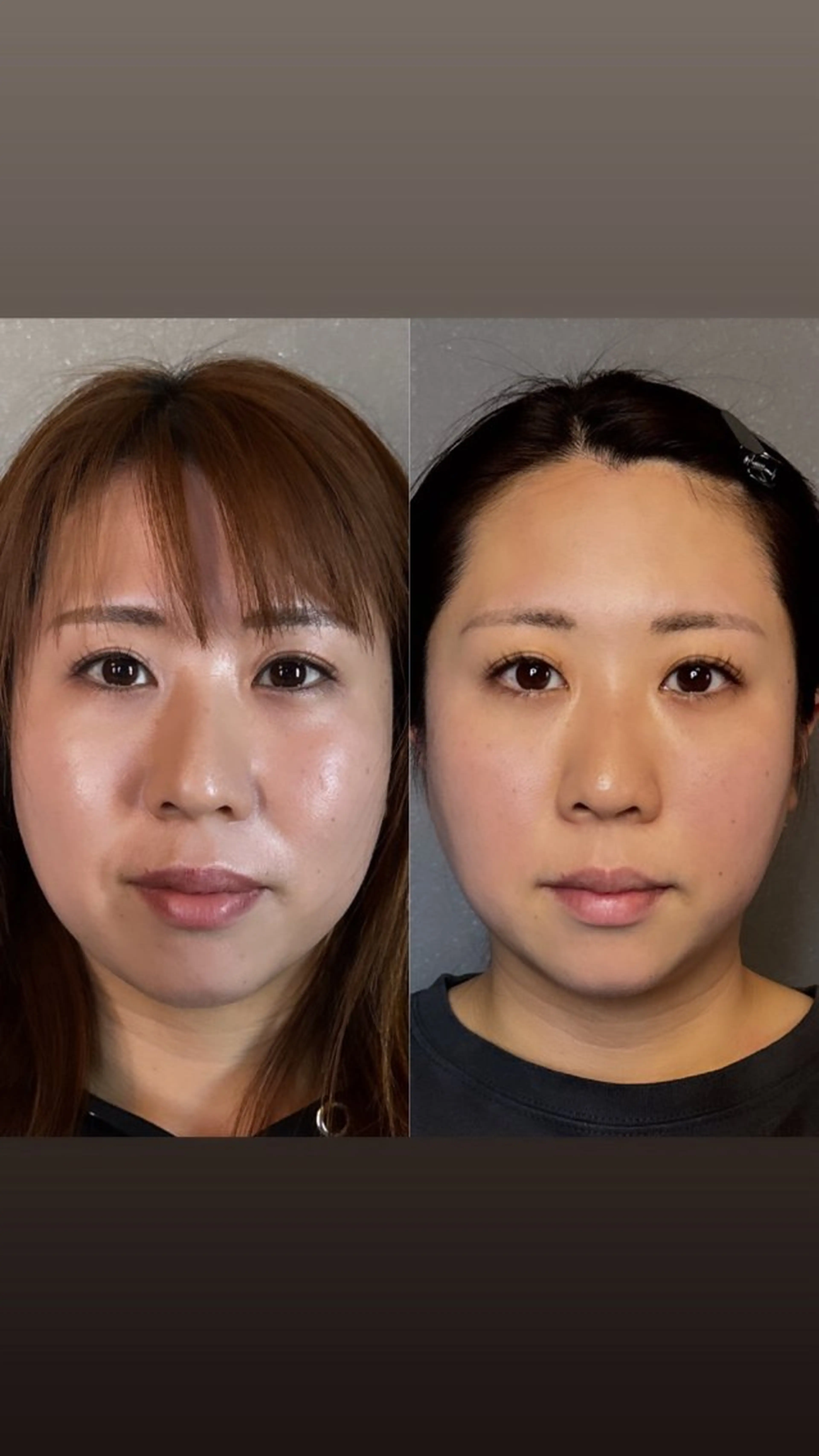 ボディーメイクサロン you.meのエステ・リラクイメージ