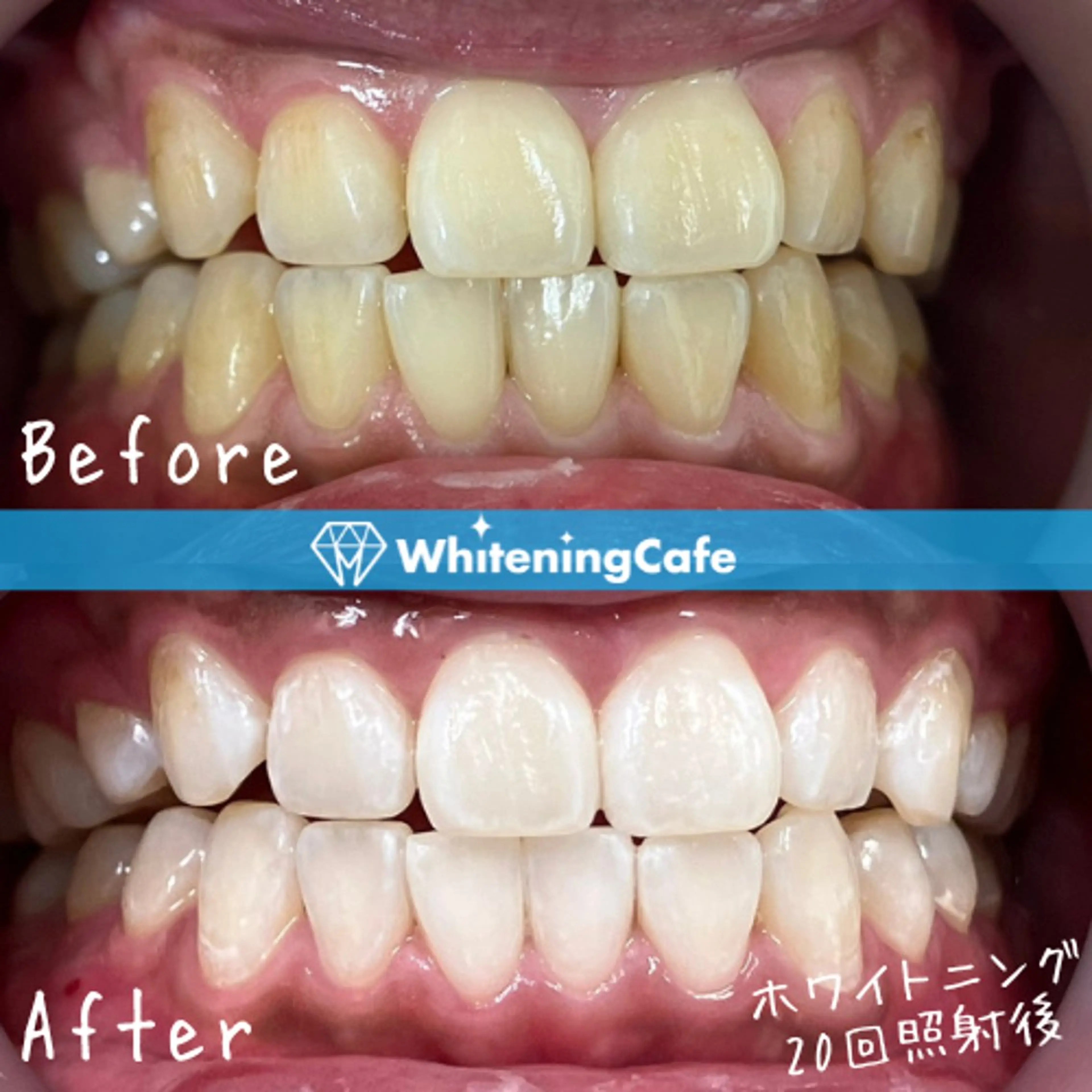 ホワイトニングカフェ徳島沖浜店所属・ホワイトニングカフェ 徳島沖浜店のエステ・リラクイメージ