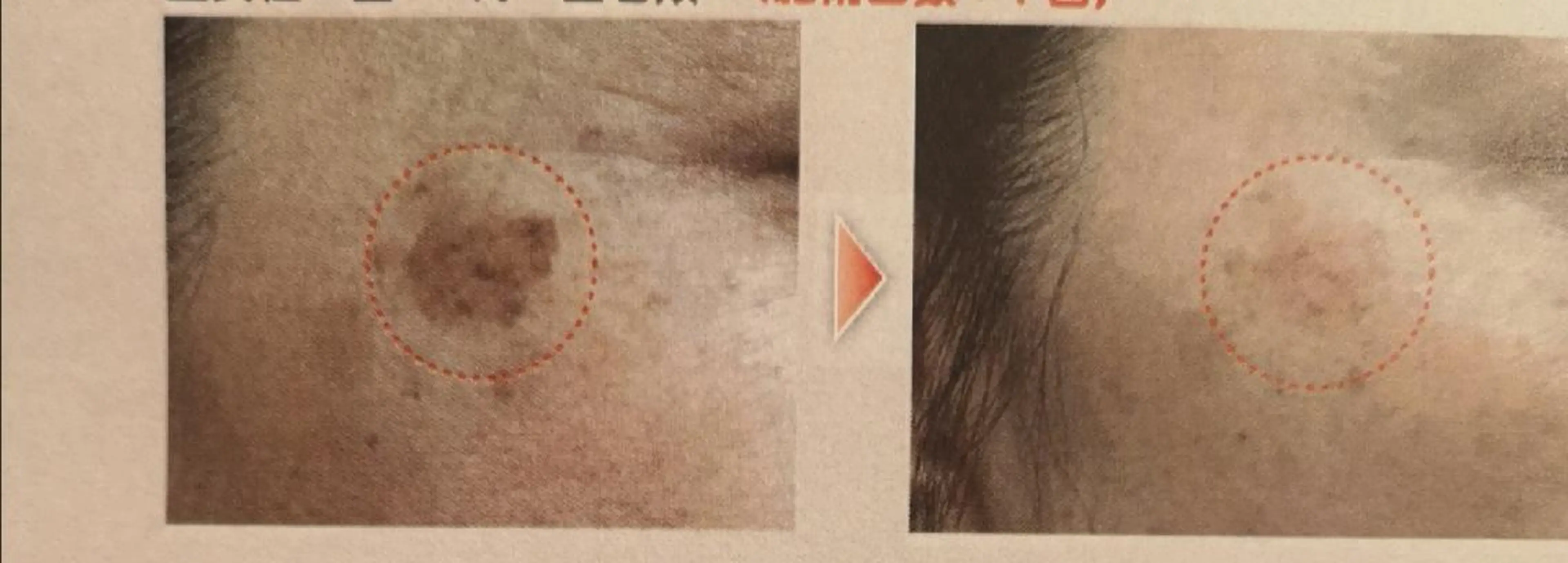 🅖🅤🅩🅔🅛 salonのエステ・リラクイメージ