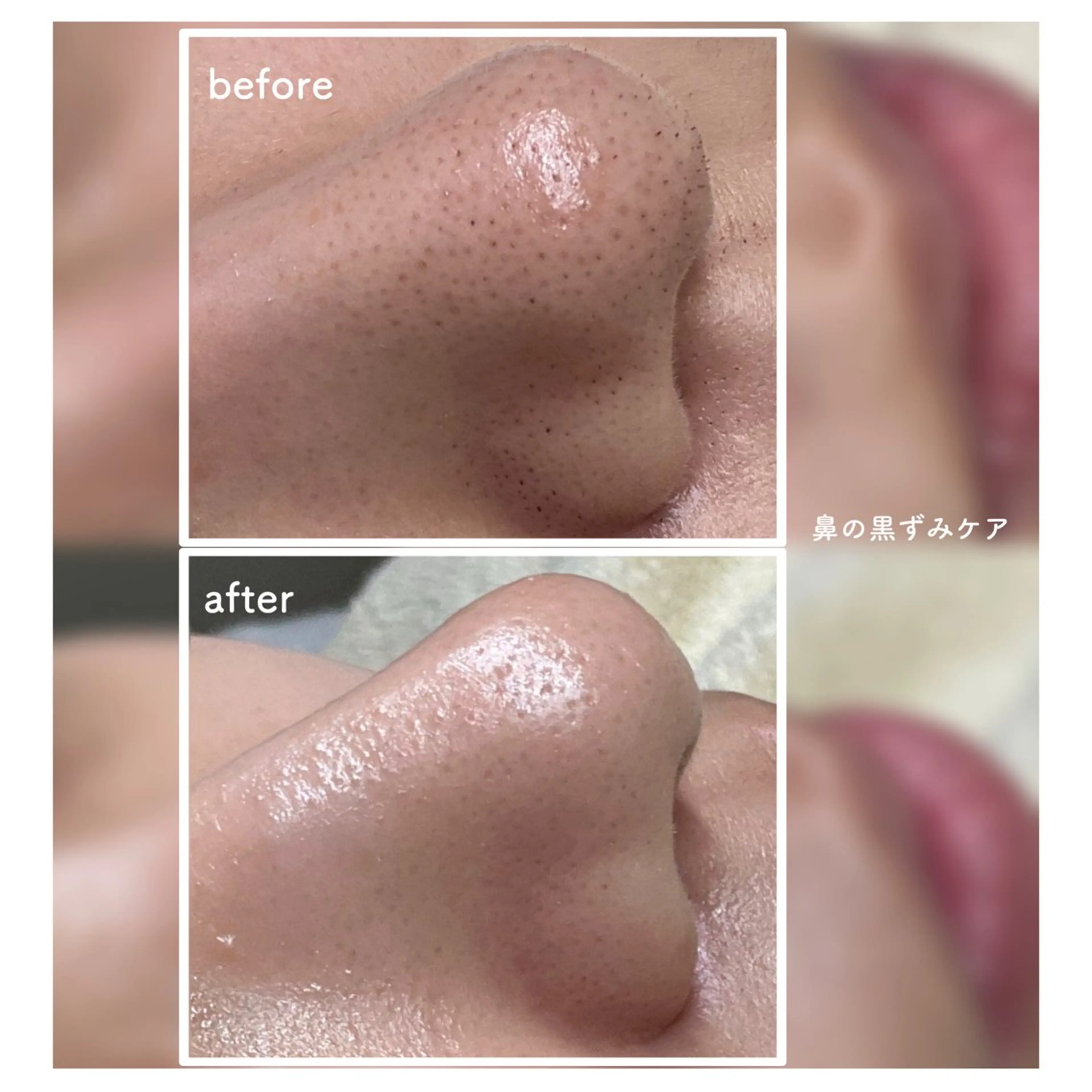 エステ And Miyon クリニカルサロンのエステ・リラクイメージ