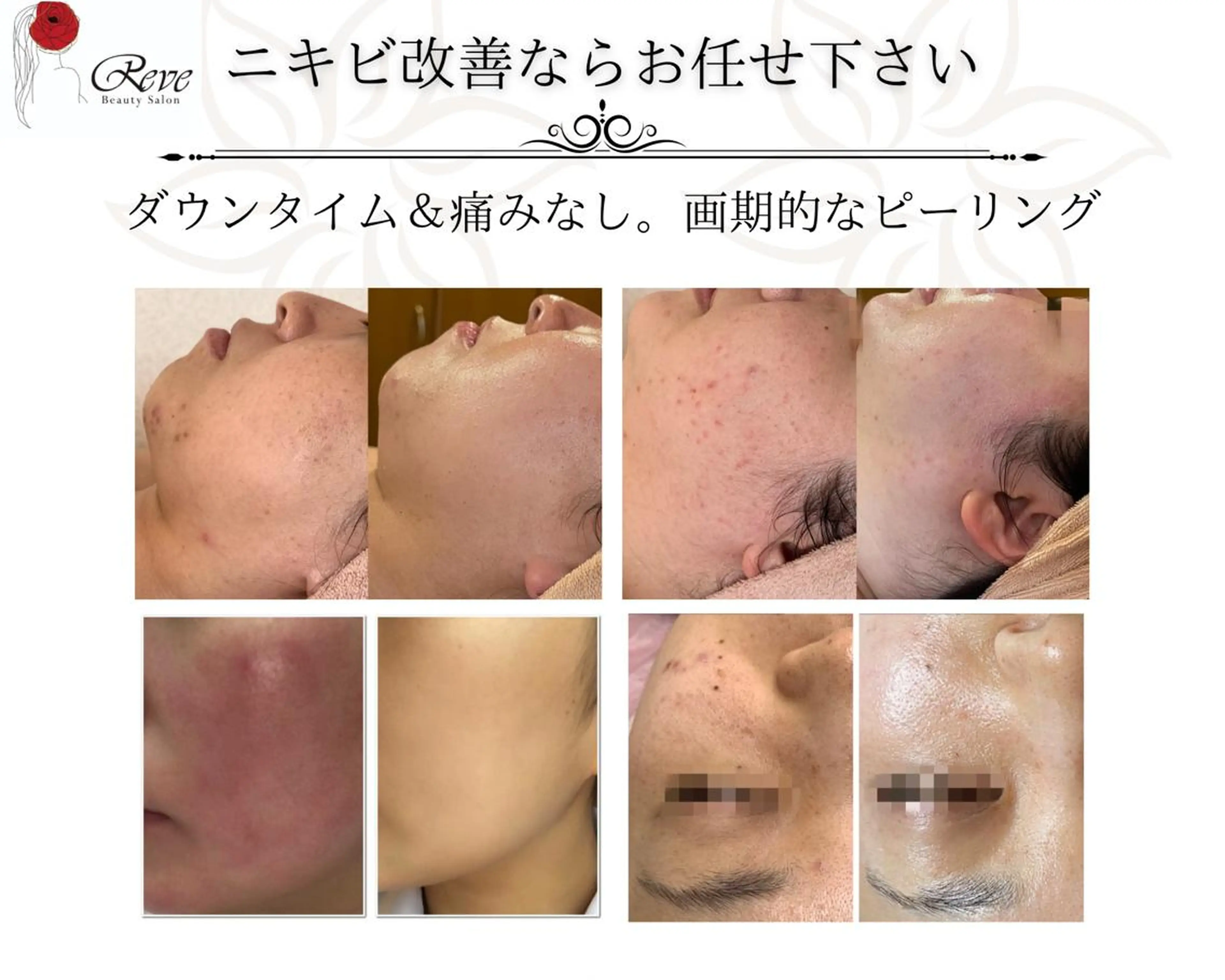 エステ リラク 堀井 舞琳のエステ・リラクイメージ