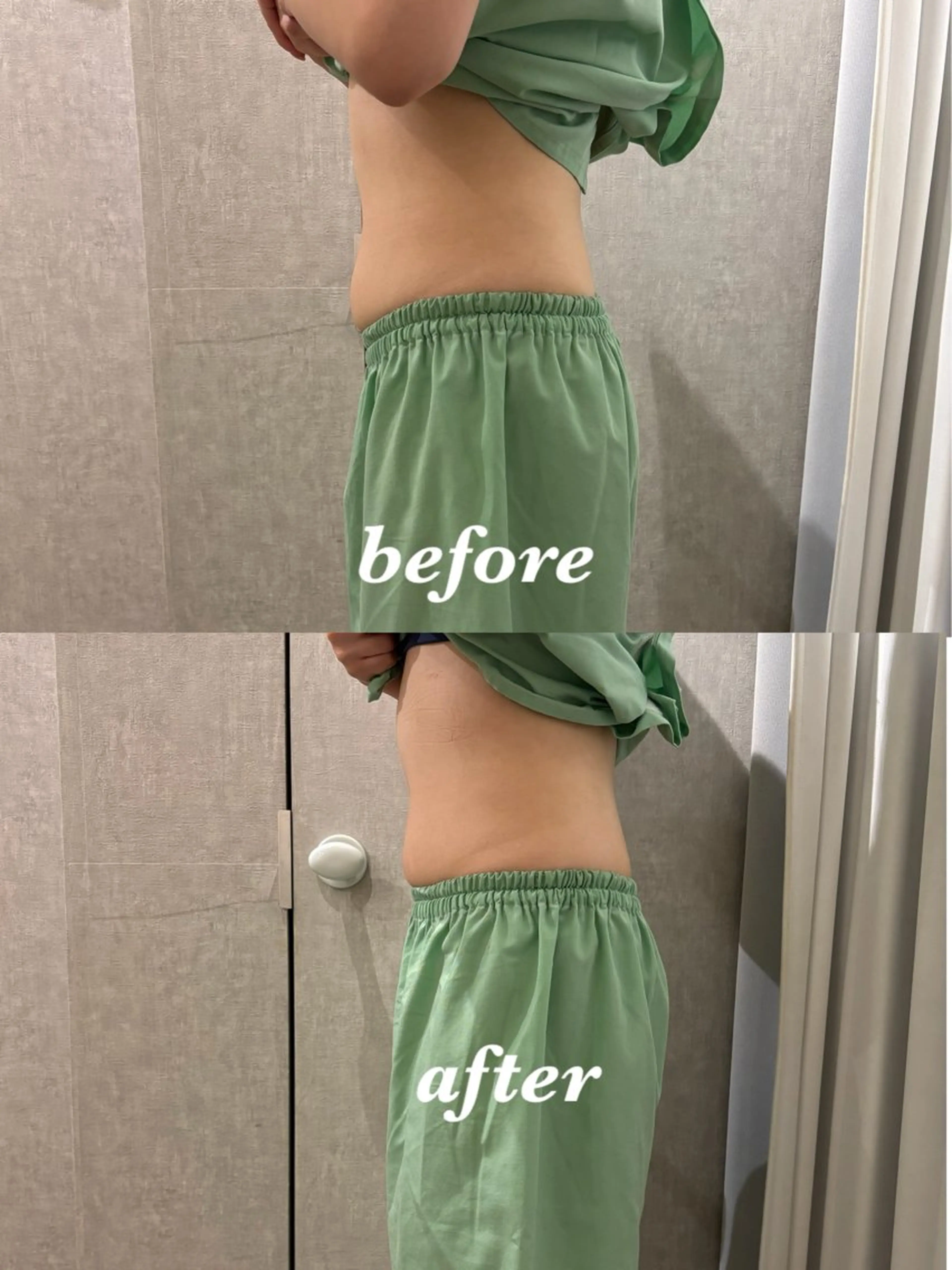 メンズ その他 腸活サポート みなみののエステ・リラクイメージ