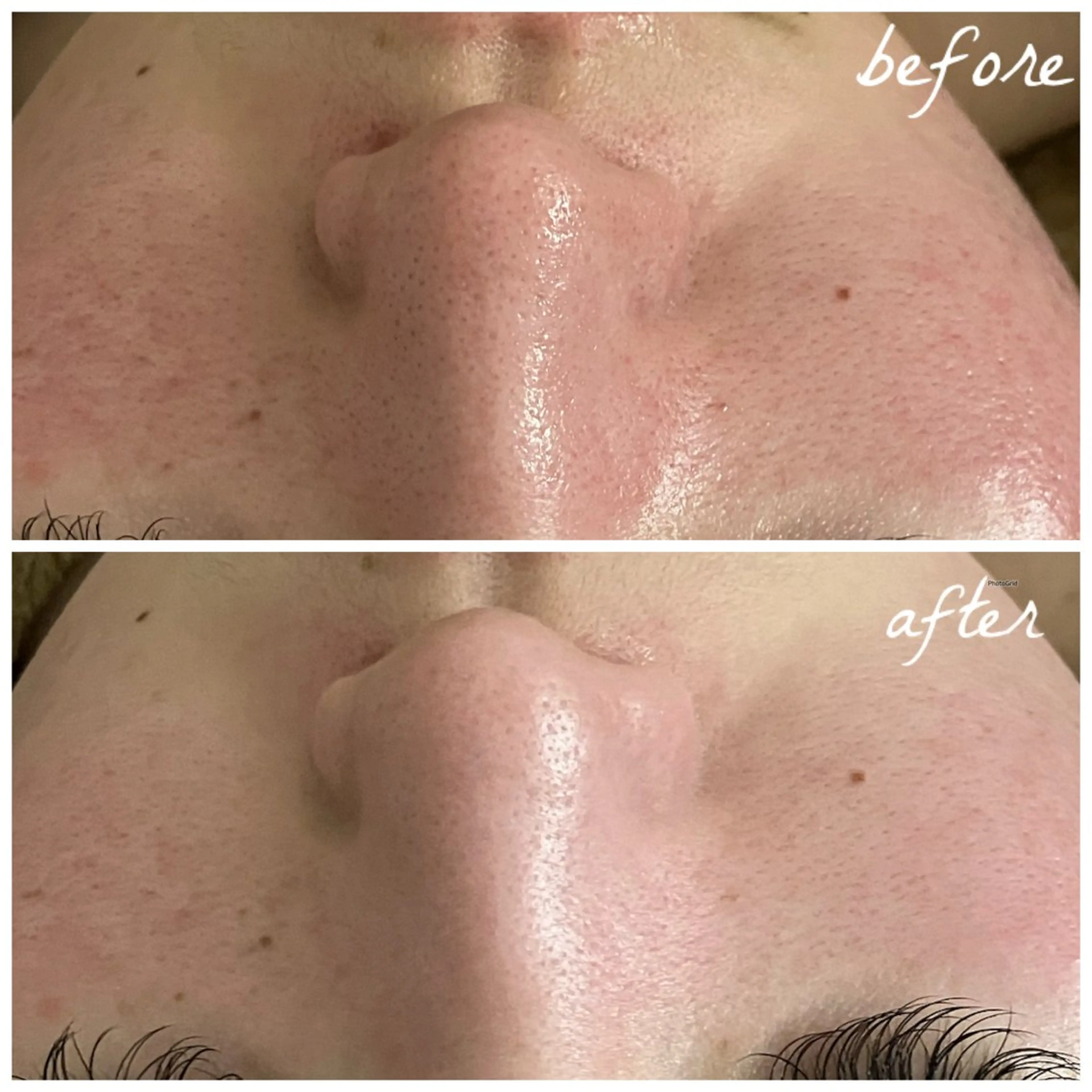 メンズ エステ メナード岐阜茜部 杉浦のエステ・リラクイメージ