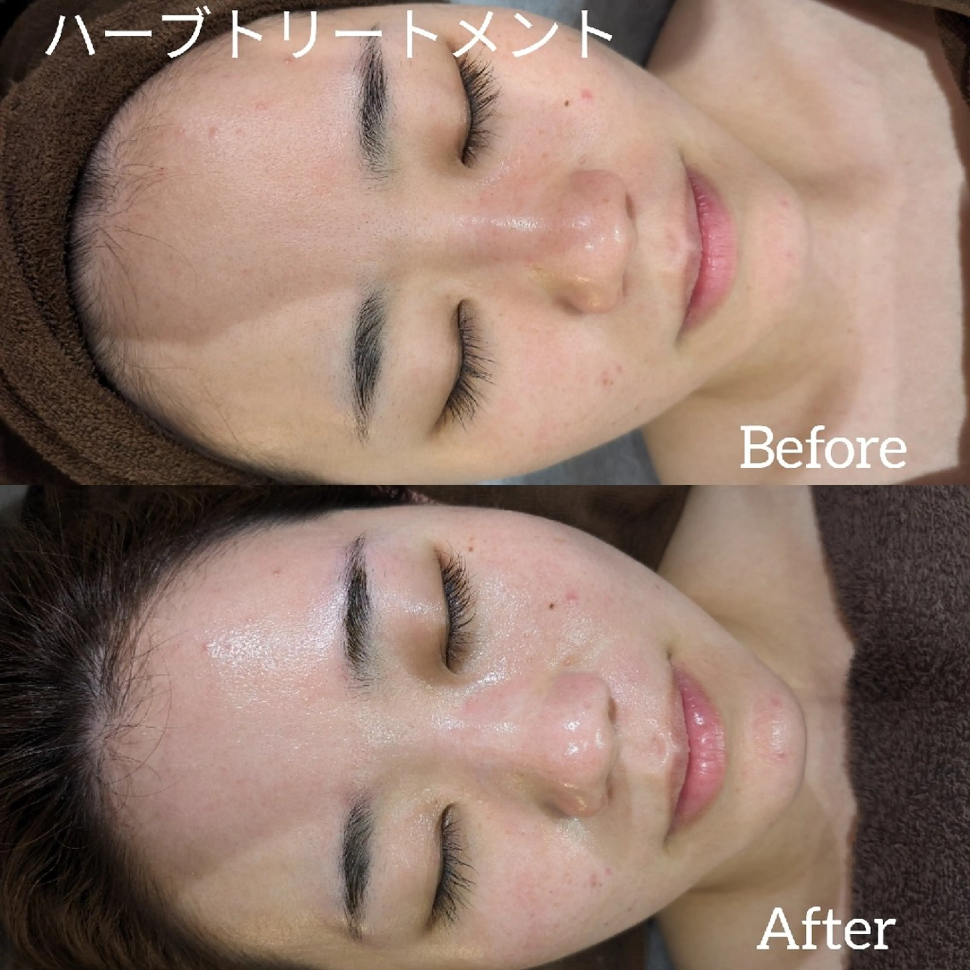 ﾌｪｲｼｬﾙｴｽﾃ ﾗﾄｩｰﾙ伊深のエステ・リラクイメージ