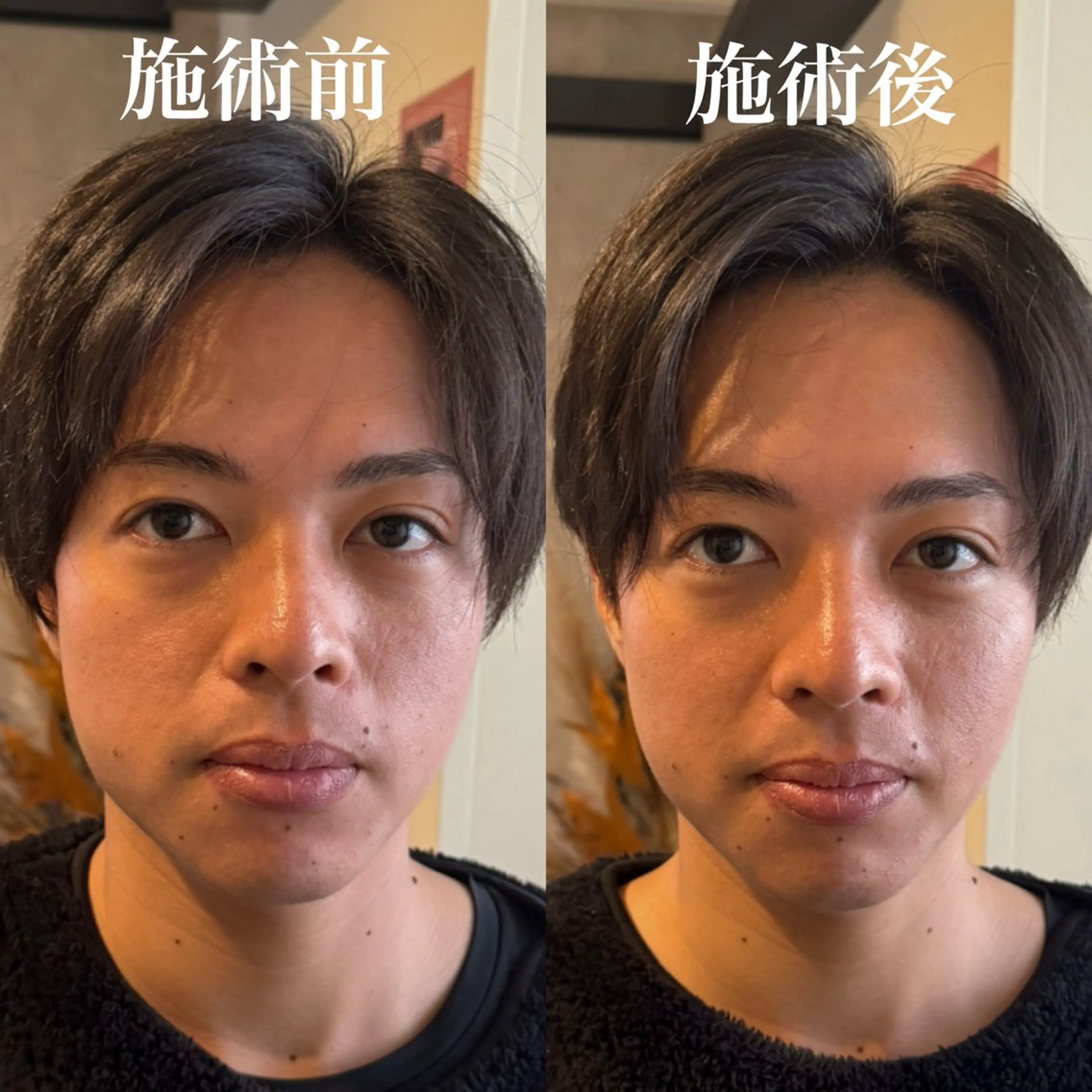 エステ 眉毛と韓国肌質改善 サロン　和泉府中のエステ・リラクイメージ