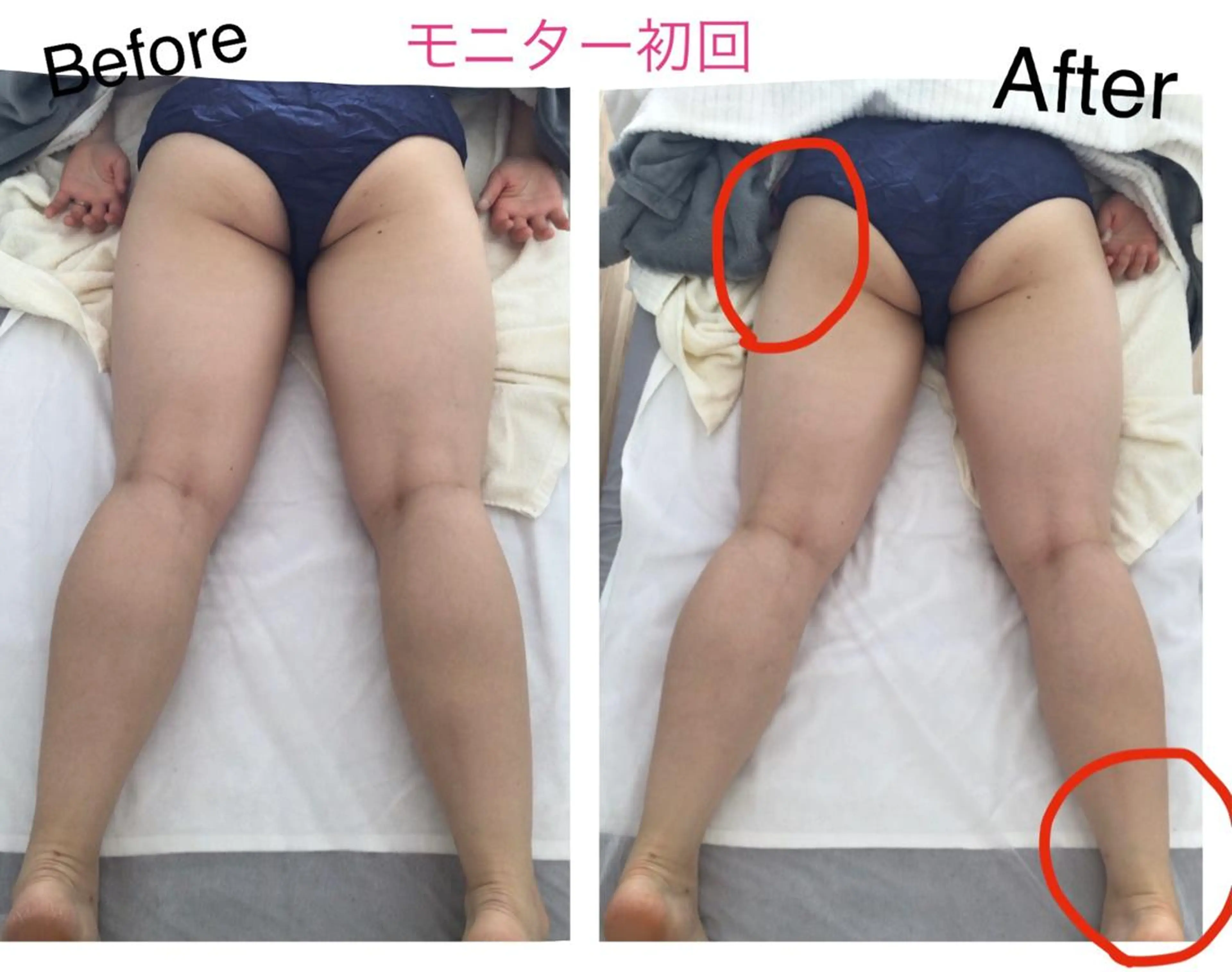 子宮矯正/腸揉み/ シュガーリング脱毛のエステ・リラクイメージ