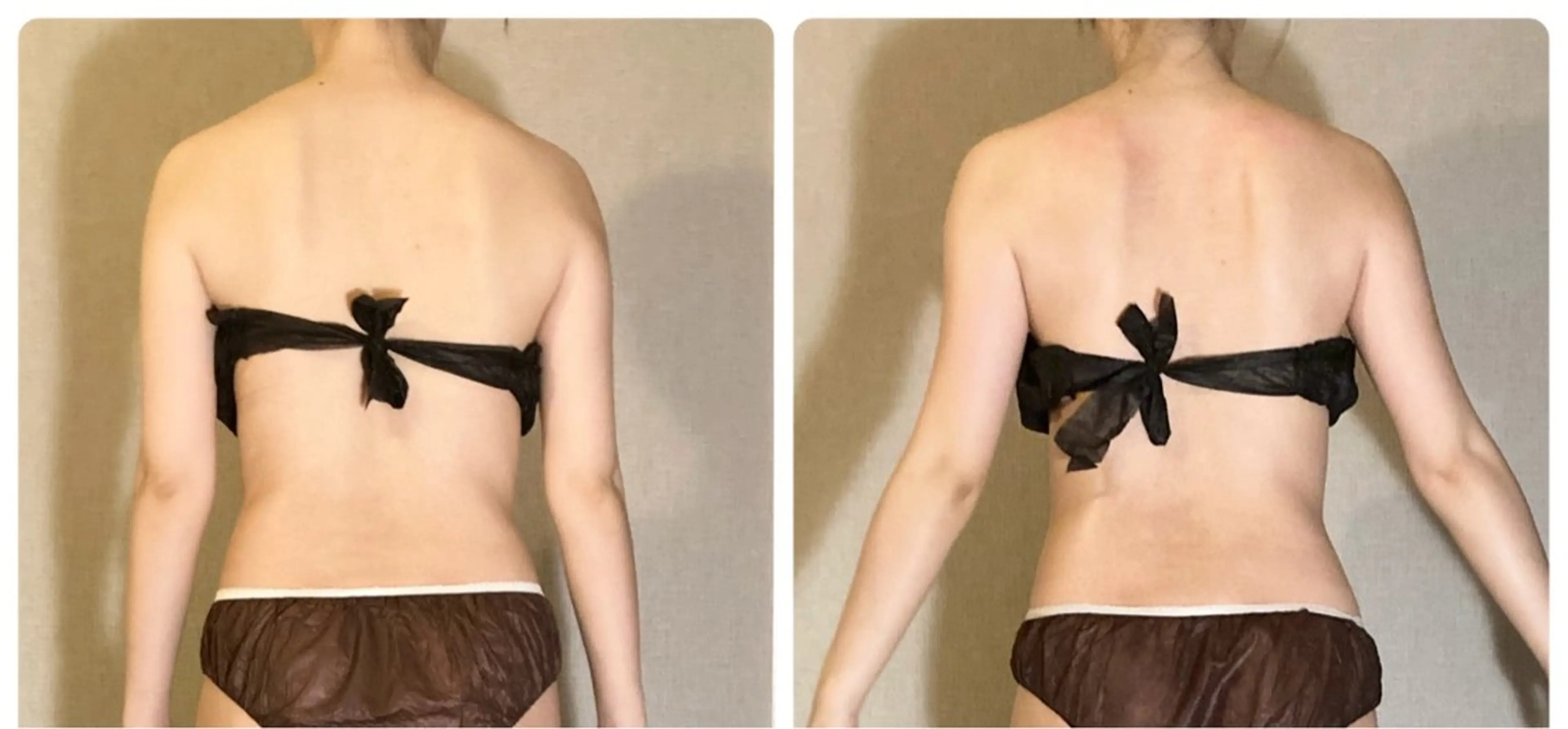 ラジオ波×リリース リラク★痩身MISAのエステ・リラクイメージ