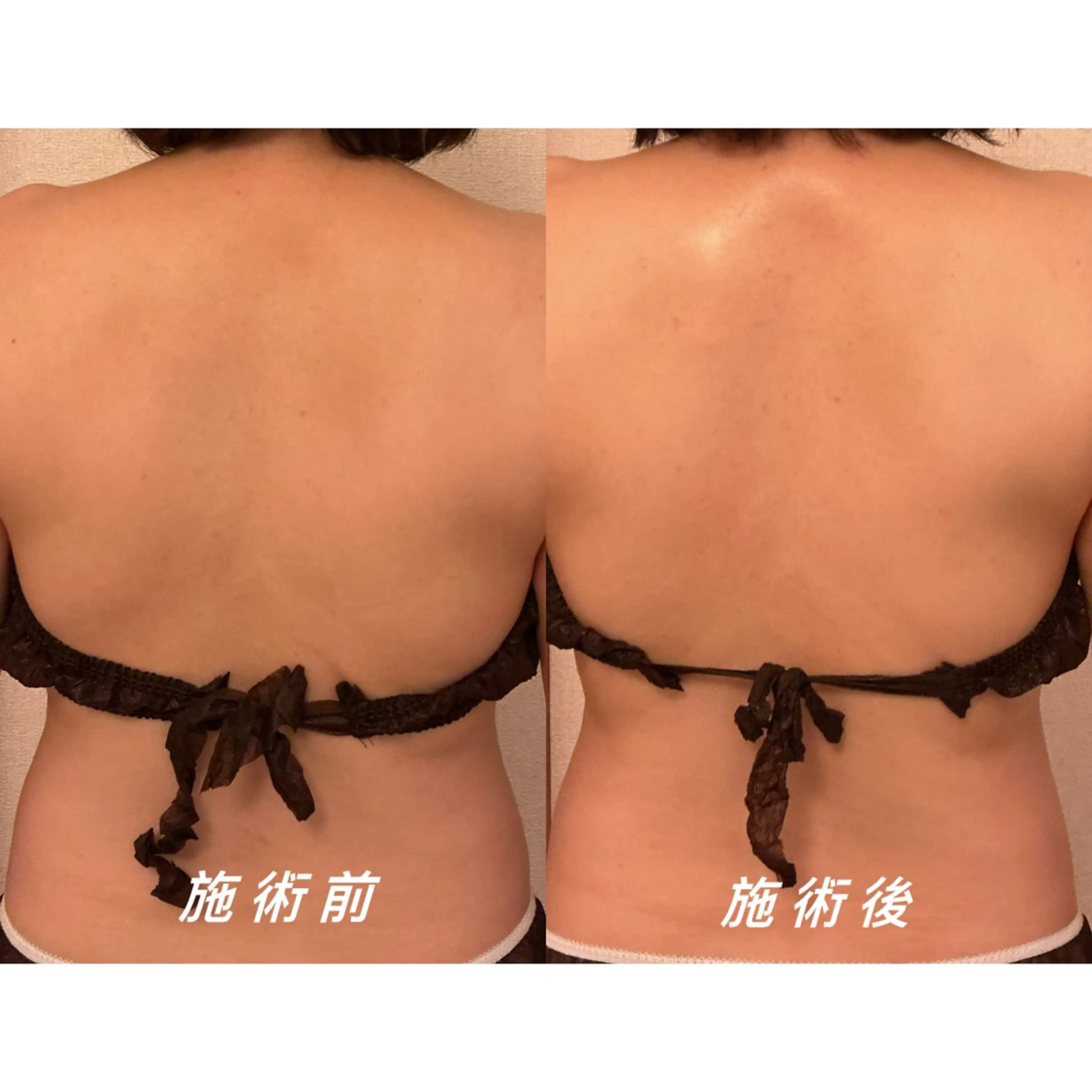 エステ リラク 痩身/リンパマッサージ専門サロン　 MOA所属・エステサロンMOA (モア)のエステ・リラクイメージ