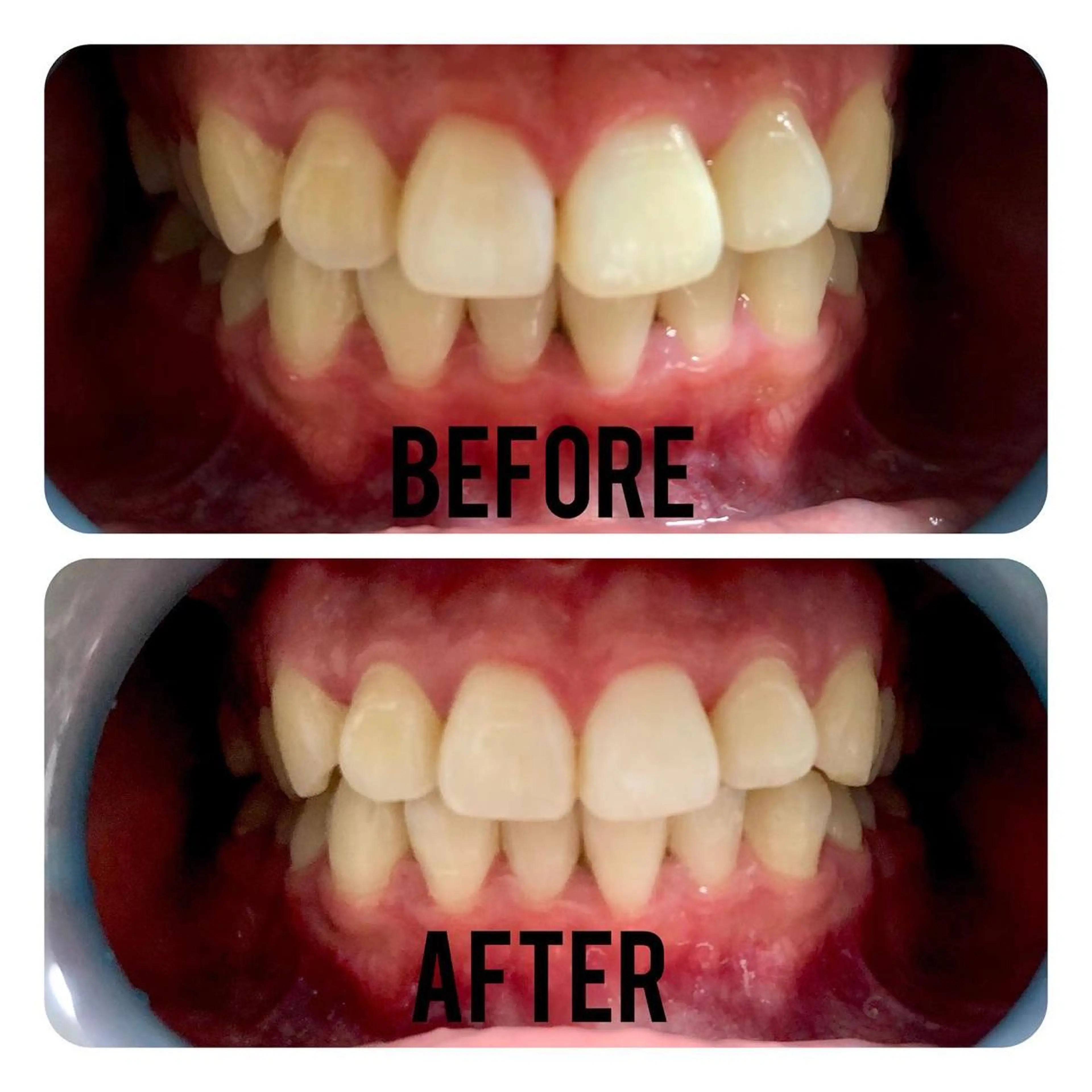 その他 two nailのネイルデザイン