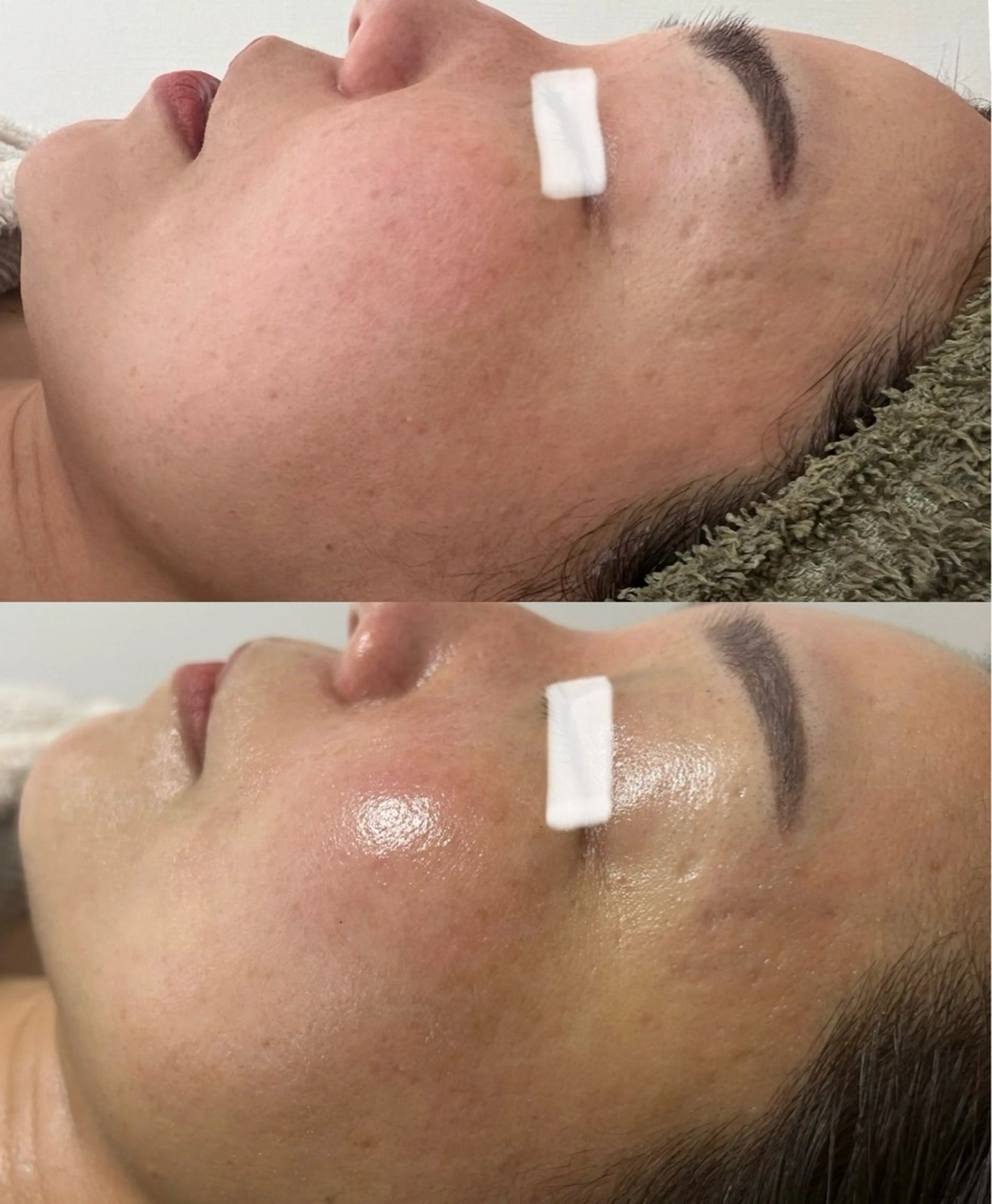 Beauty   Salon  Adiy所属・Adiy ikumiのエステ・リラクイメージ