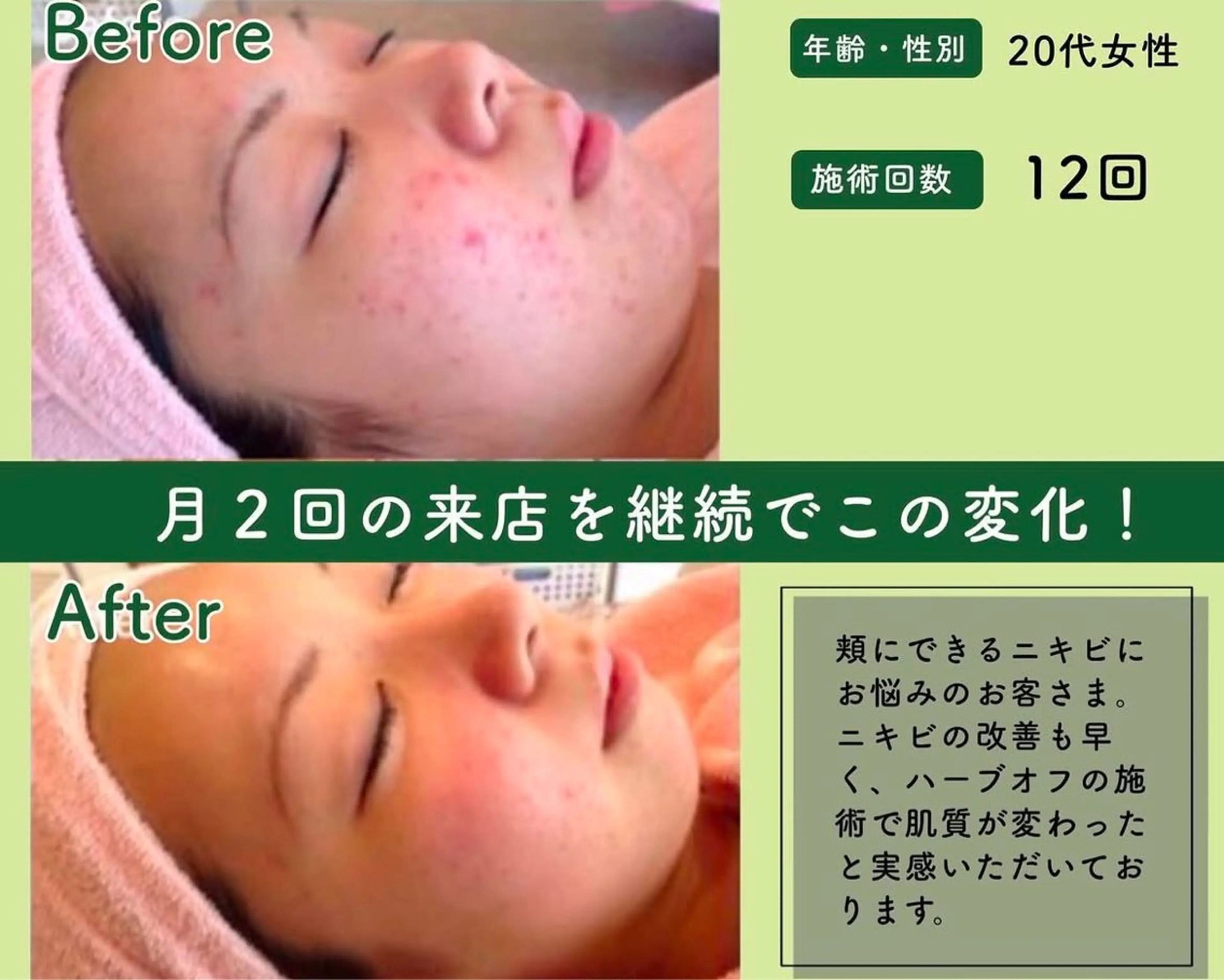 M.plus所属・水光韓国肌ハーブ ピーリングMplusのエステ・リラクイメージ