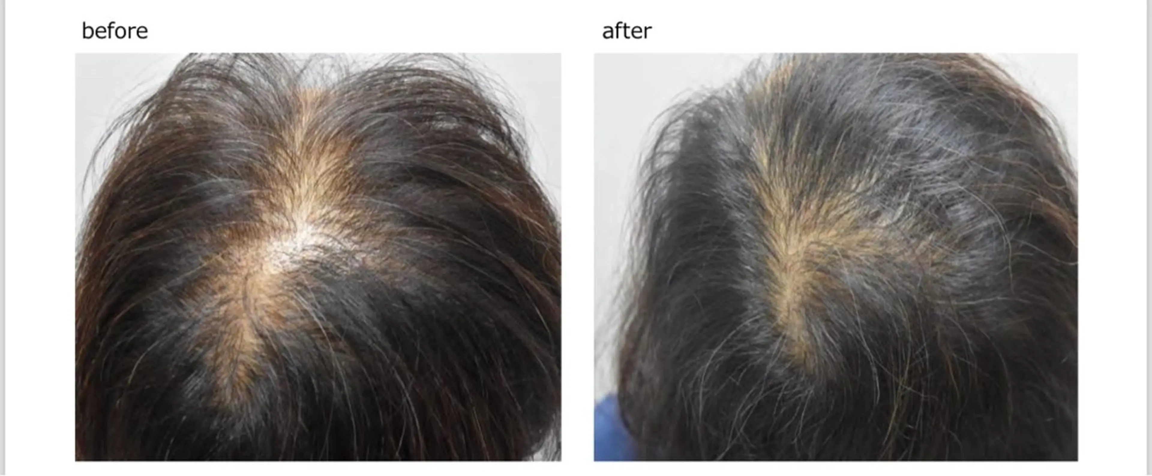 ショート 髪質改善専門 ゆうぞうのヘアスタイル