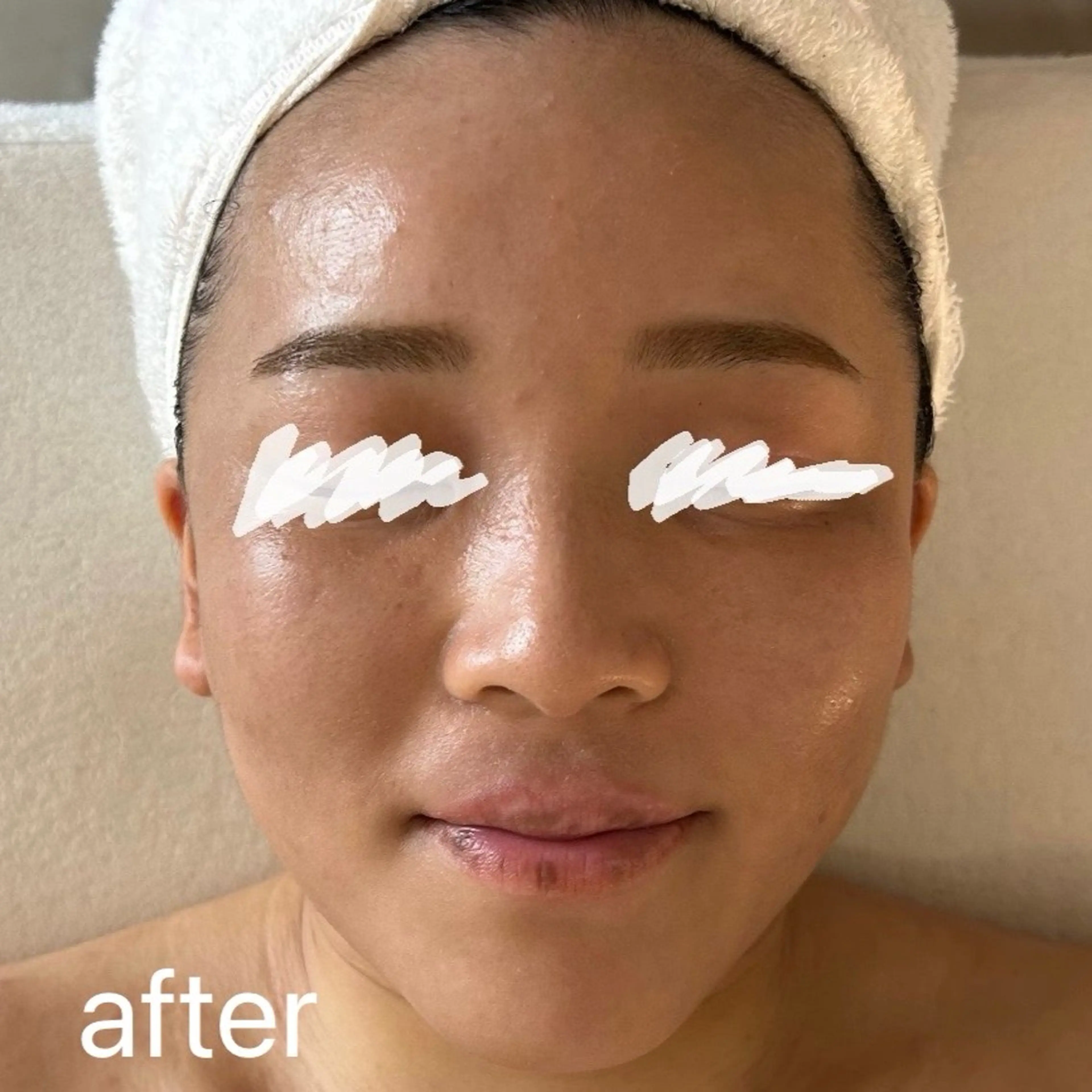 エステ 肌質改善|天王寺 For...はるかのエステ・リラクイメージ