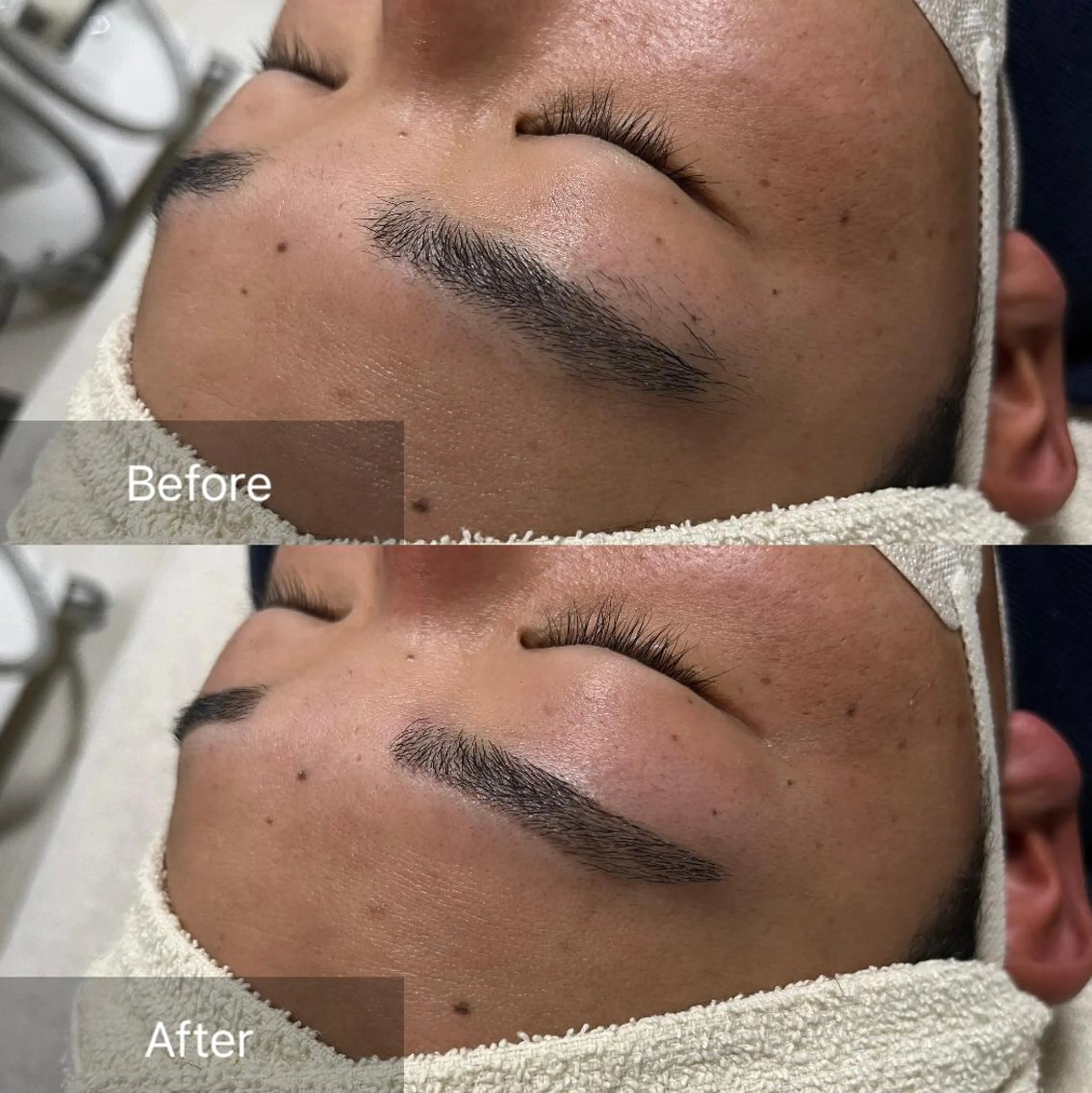 アイブロウ for woman所属・森 美優のエステ・リラクイメージ