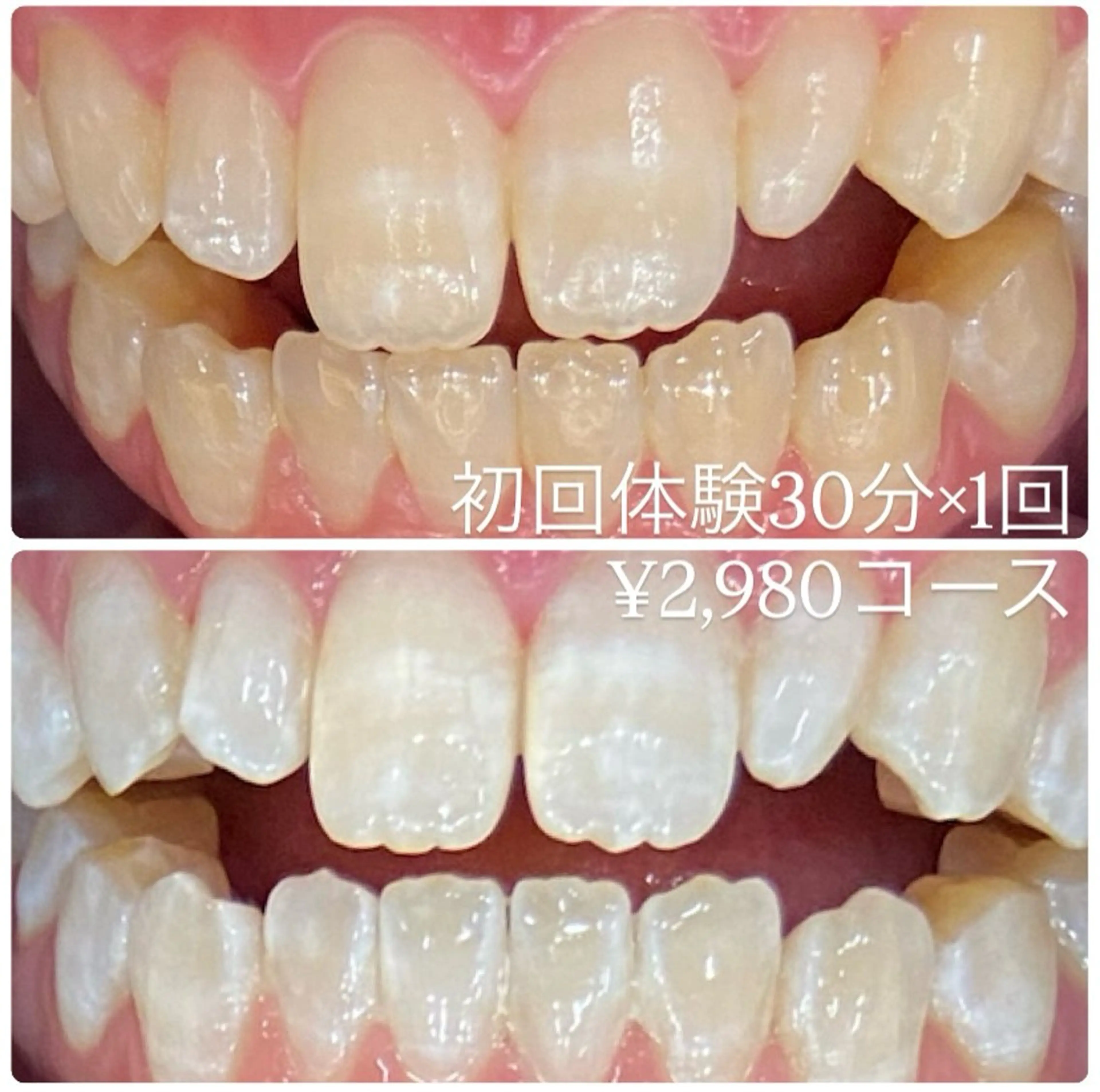 PLATINUM Beauty 横浜店所属・ホワイトニングルーム 横浜店のその他イメージ