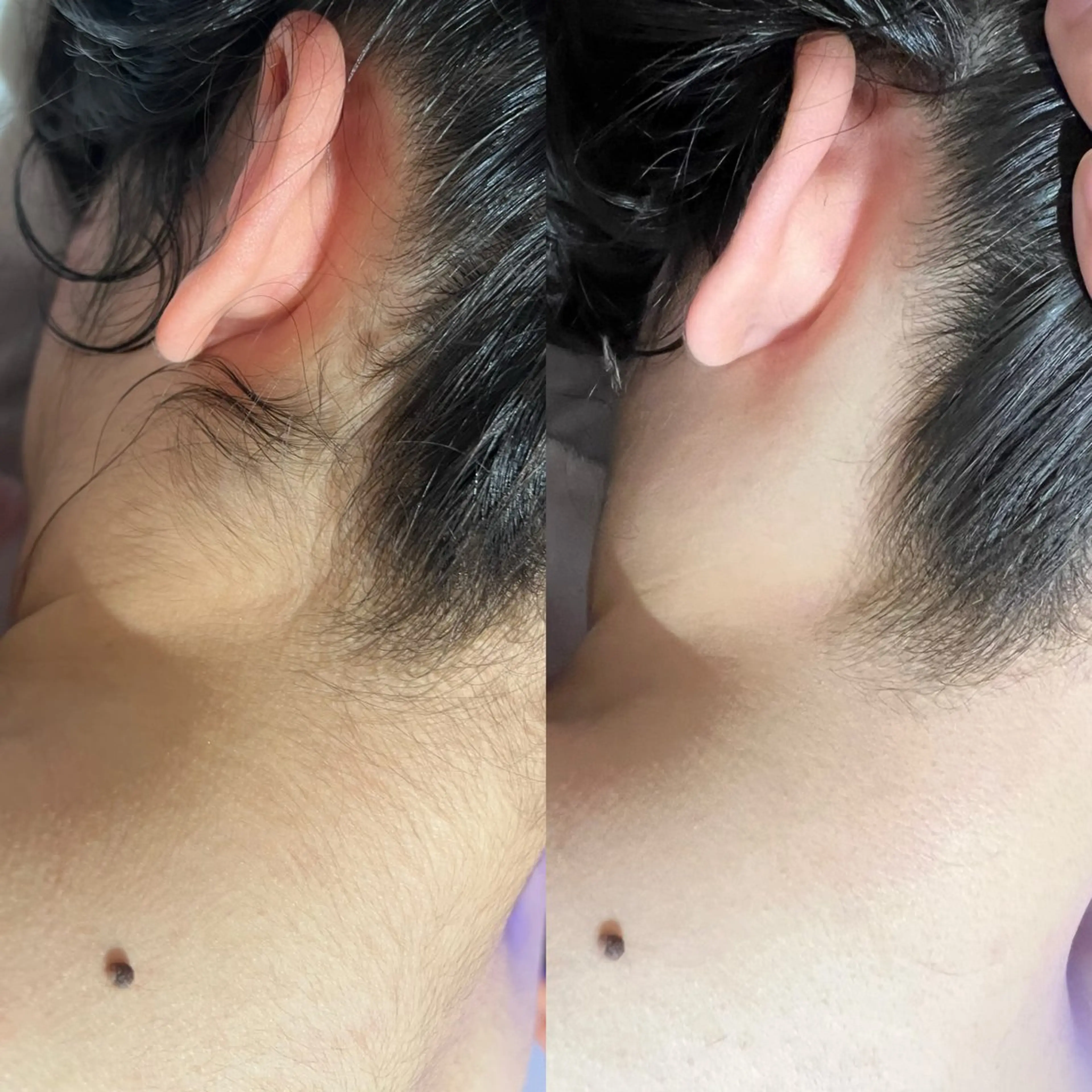 beautysalon FourV所属・名駅🌼無痛美肌脱毛 /フェイシャルのエステ・リラクイメージ