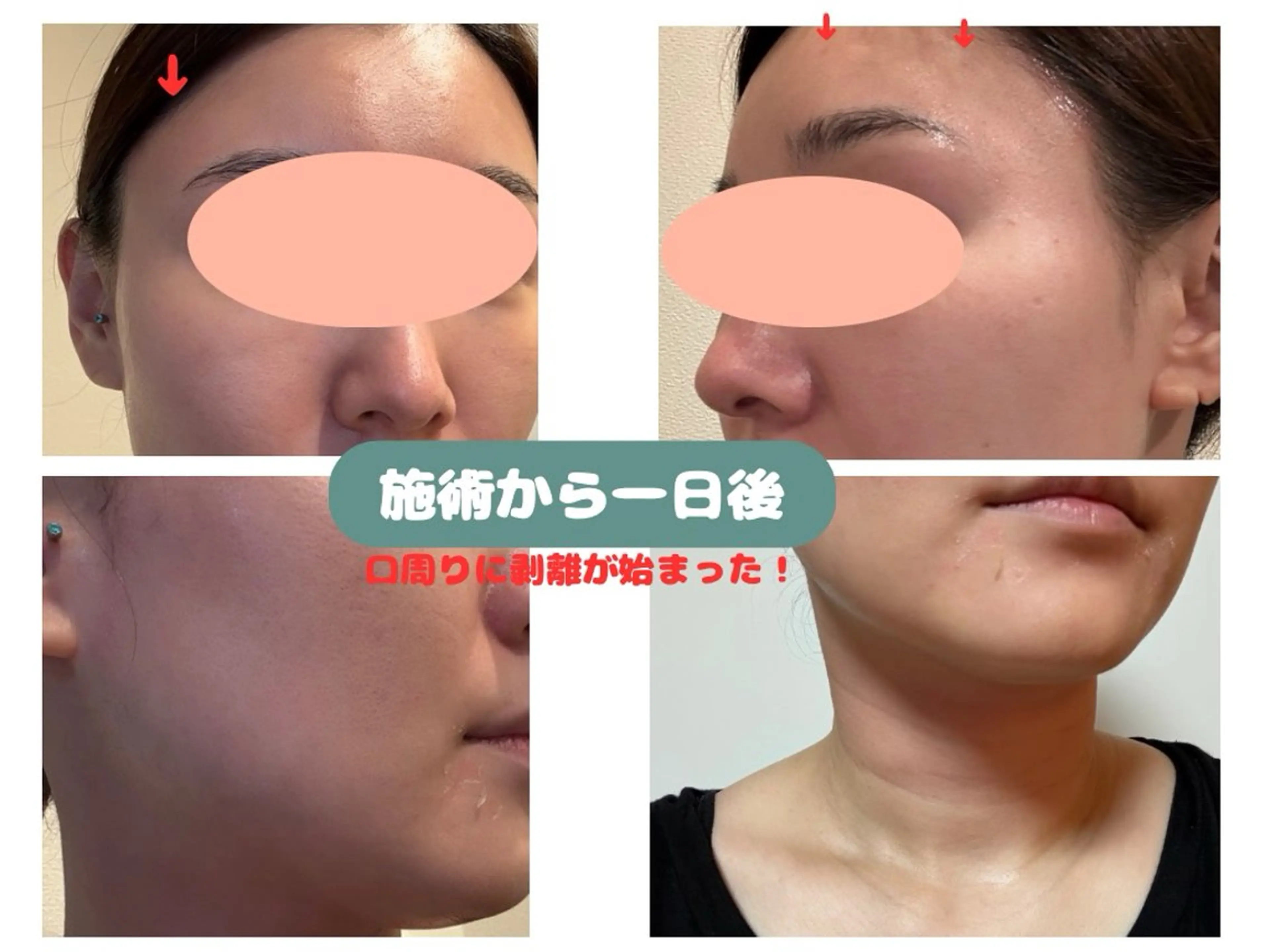 VIKI BEAUTY  クレイハーブピーリング・美肌脱毛専門店所属・VIKI BEAUTYのエステ・リラクイメージ