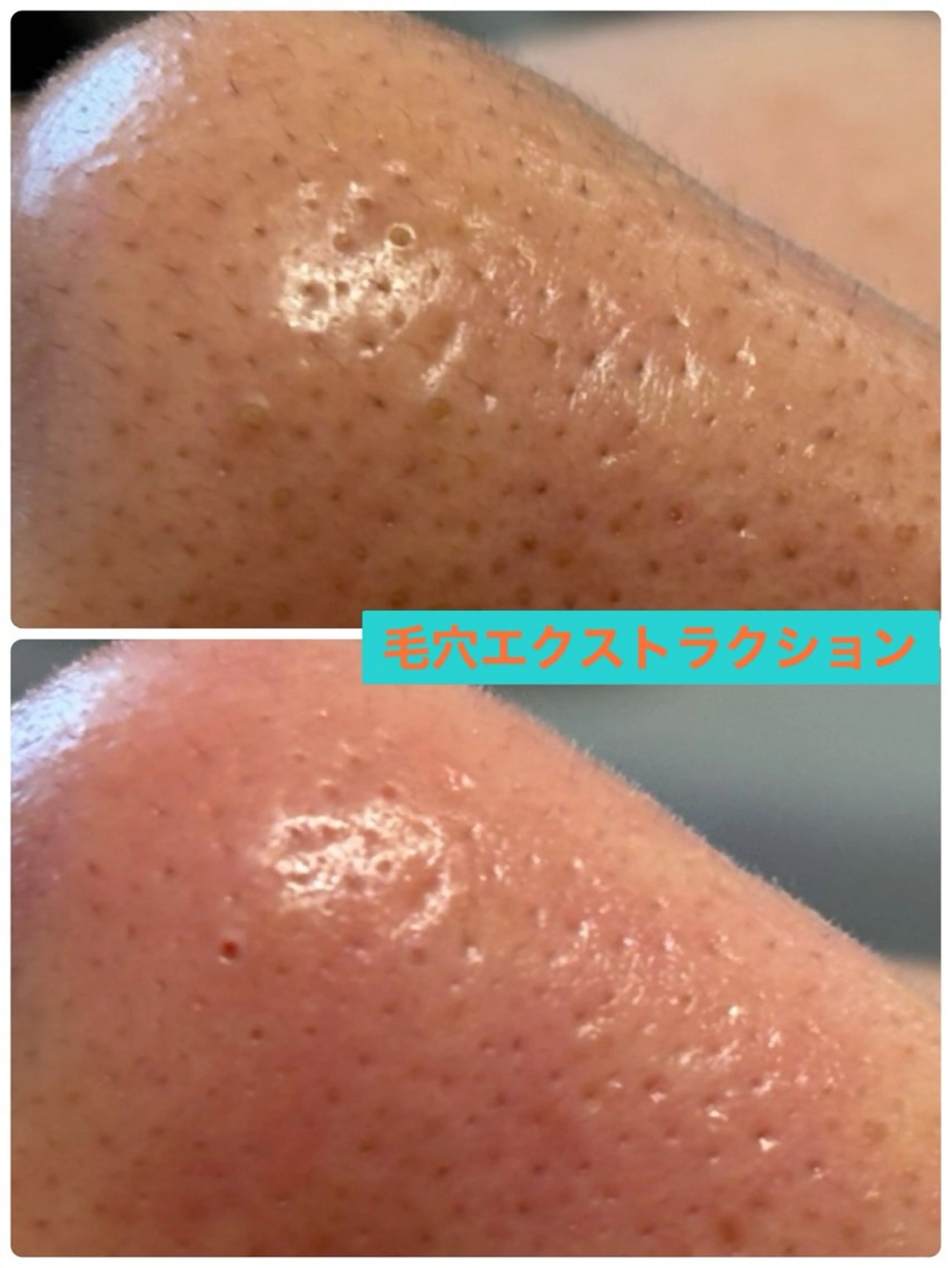 メンズ エステ Private Salon Prunelle所属・プライベートサロン プリュネルのエステ・リラクイメージ