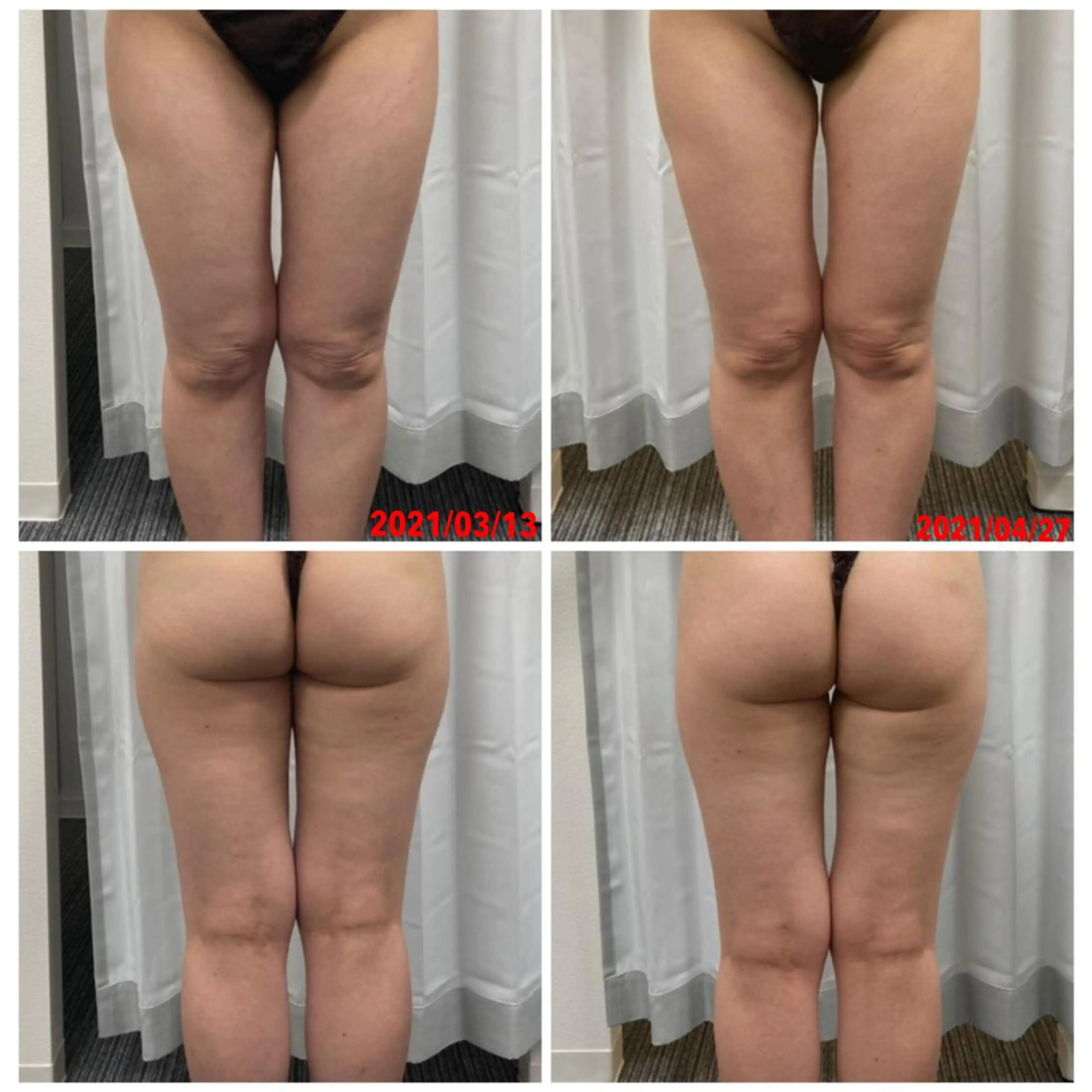 透明感の肌Lino malieのエステ・リラクイメージ