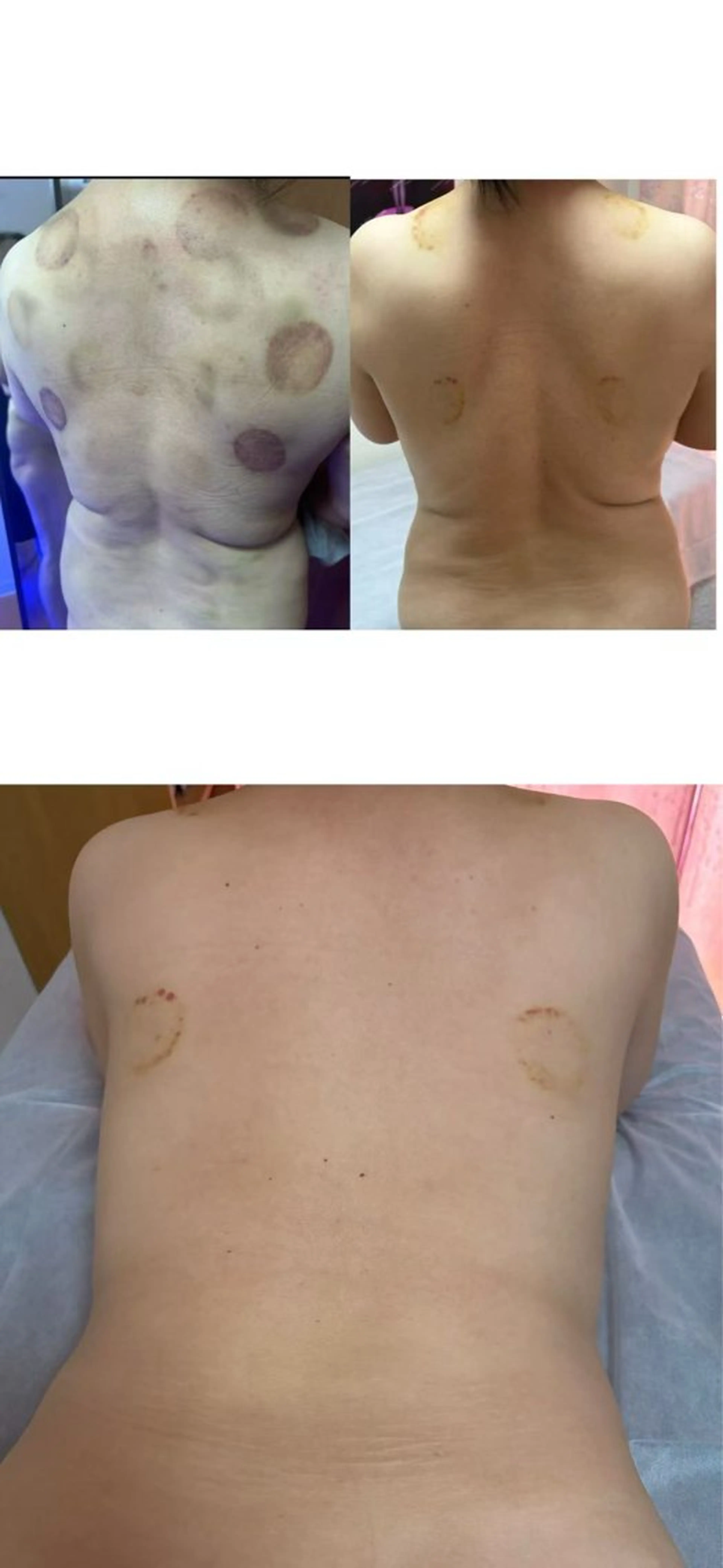 健康カプセルサロン所属・健康カプセルサロン ユキのエステ・リラクイメージ