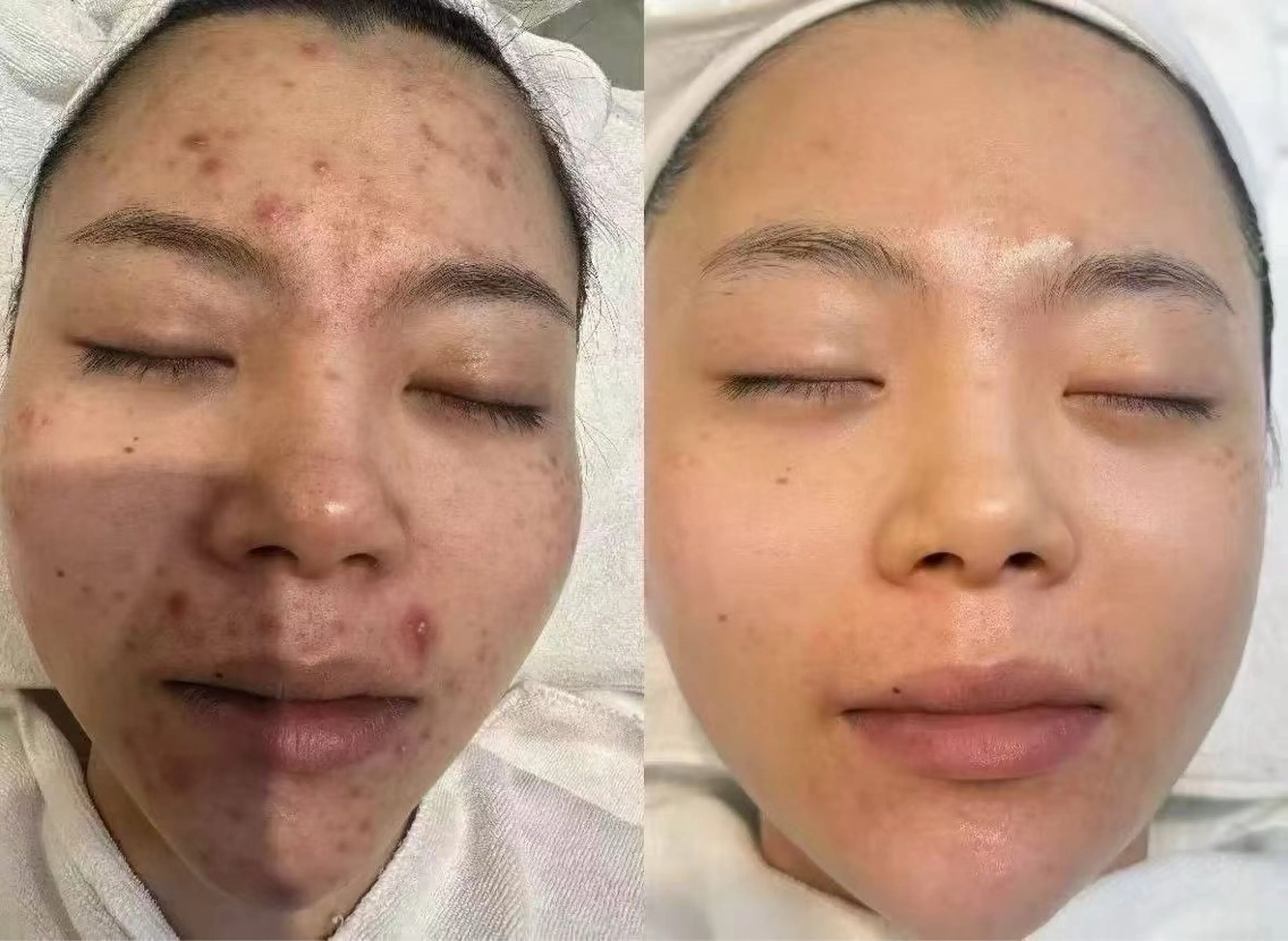 マツエク・マツパ エステ aliaハイフ&水光ジェットサロン所属・aliaハーブ水光店 エステティシャン募集のエステ・リラクイメージ